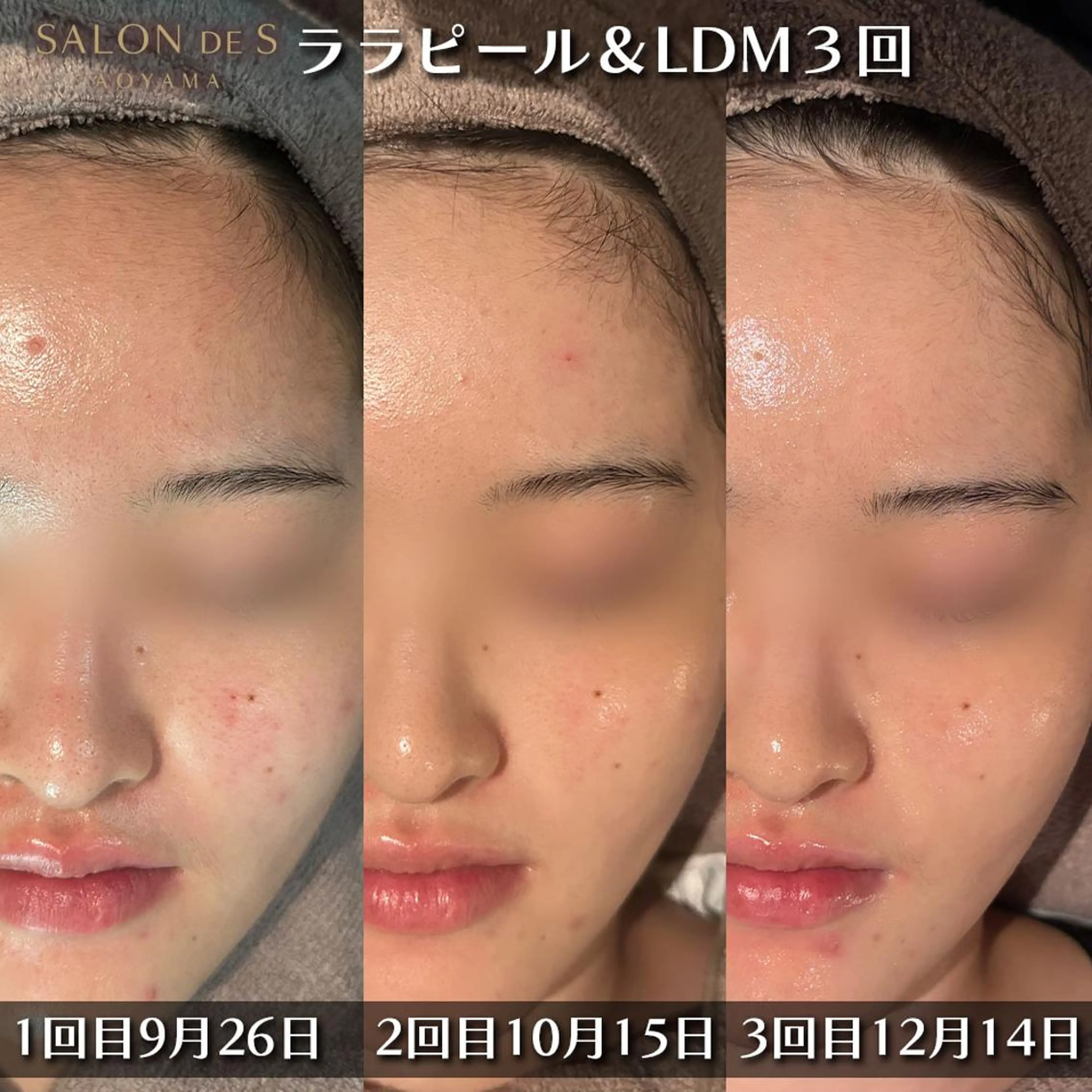 SALON DE S 外苑前♡さやかのエステ・リラクイメージ