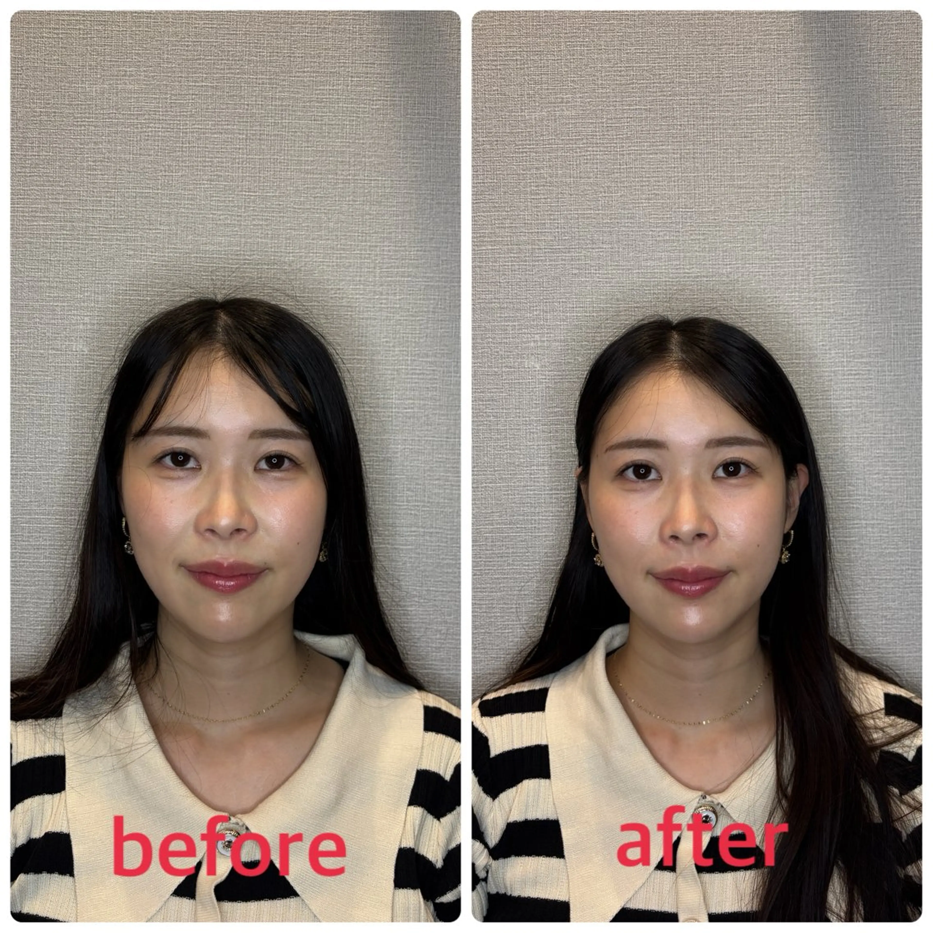 エステ リラク 小林整骨院本町 美容鍼roomのエステ・リラクイメージ