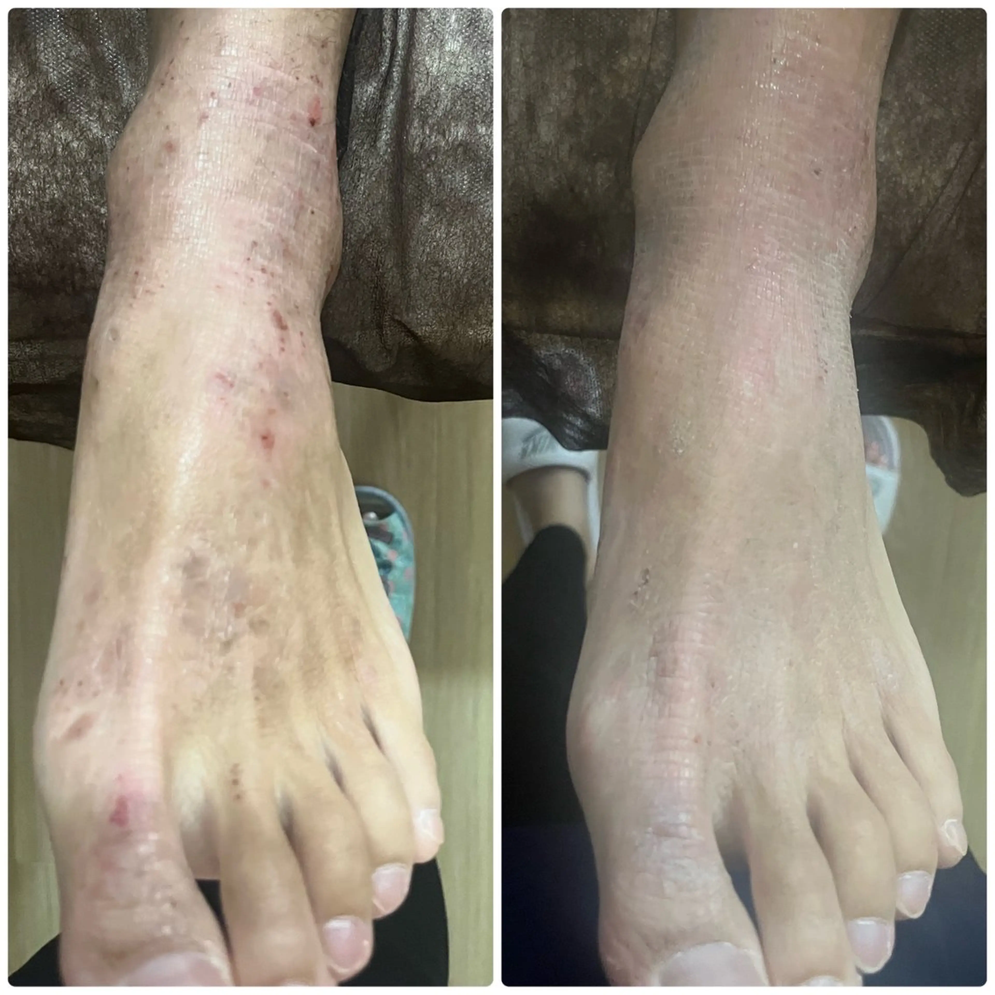 アロマ･美容鍼･カッ ピング「麗」鍼灸院のエステ・リラクイメージ