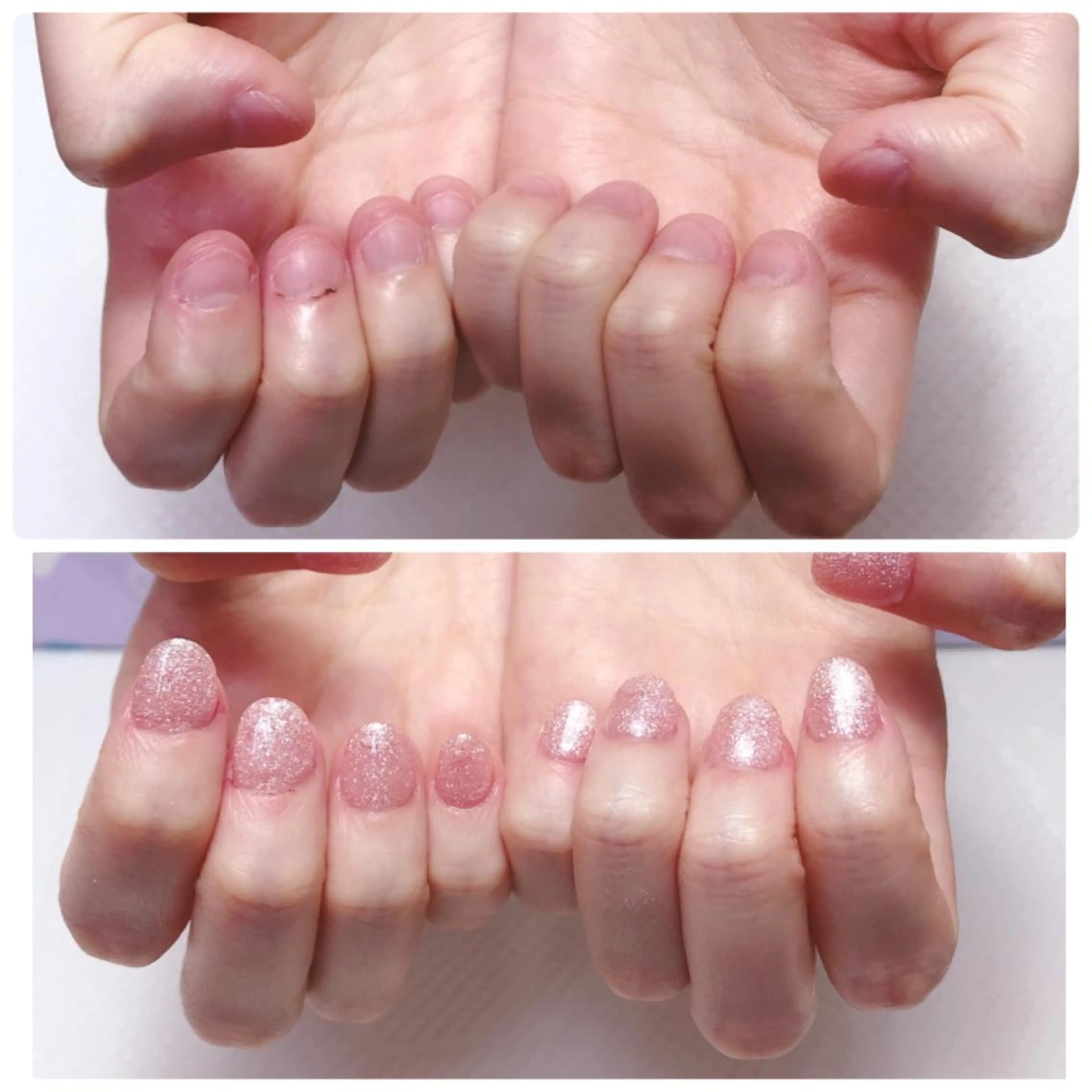 ネイル ハンドネイル 深爪を断らない スカルプ高評価店のネイルデザイン