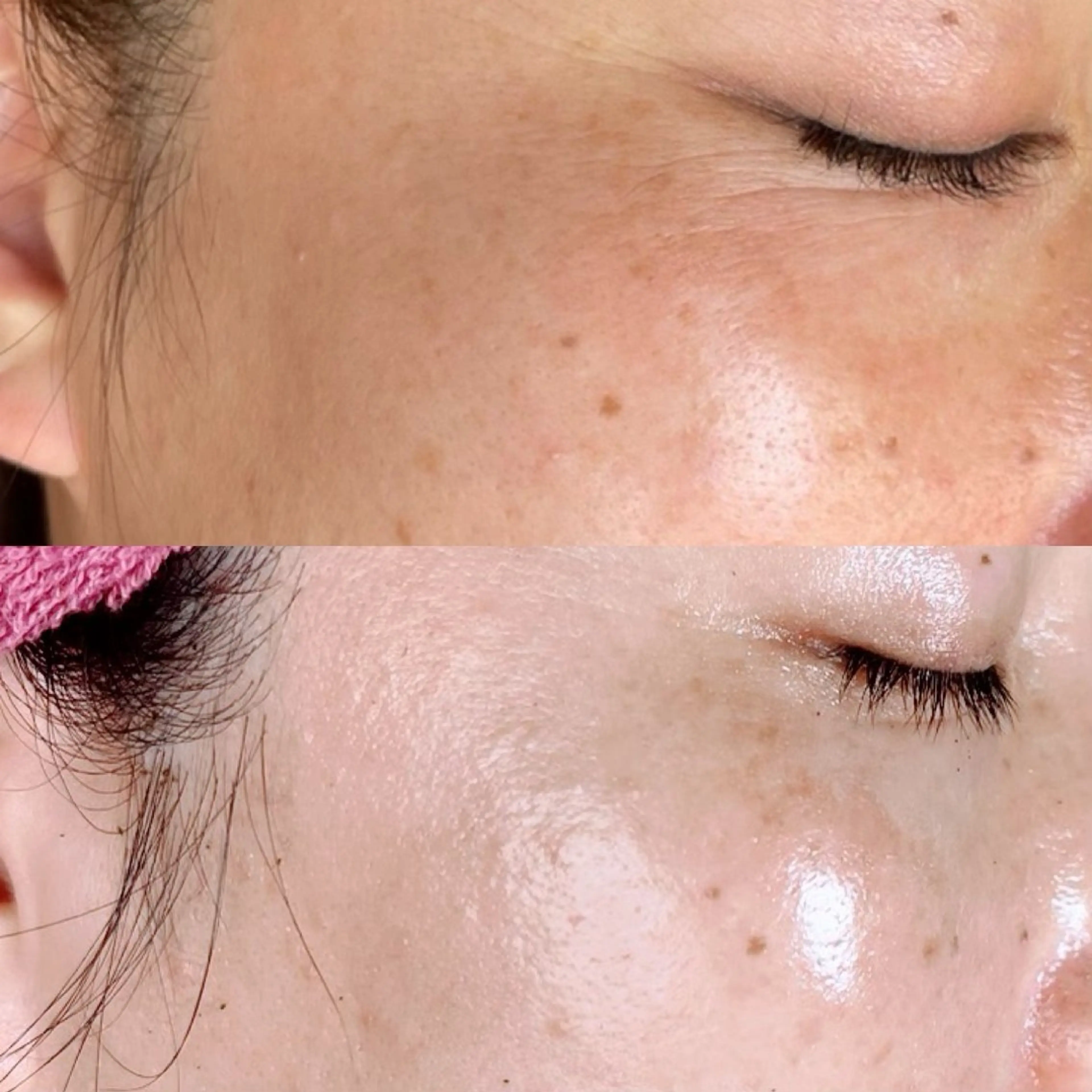 エステ 脱毛和みサロン新茶屋所属・脱毛和みサロン新茶屋 ひろみ（女性専用）のエステ・リラクイメージ