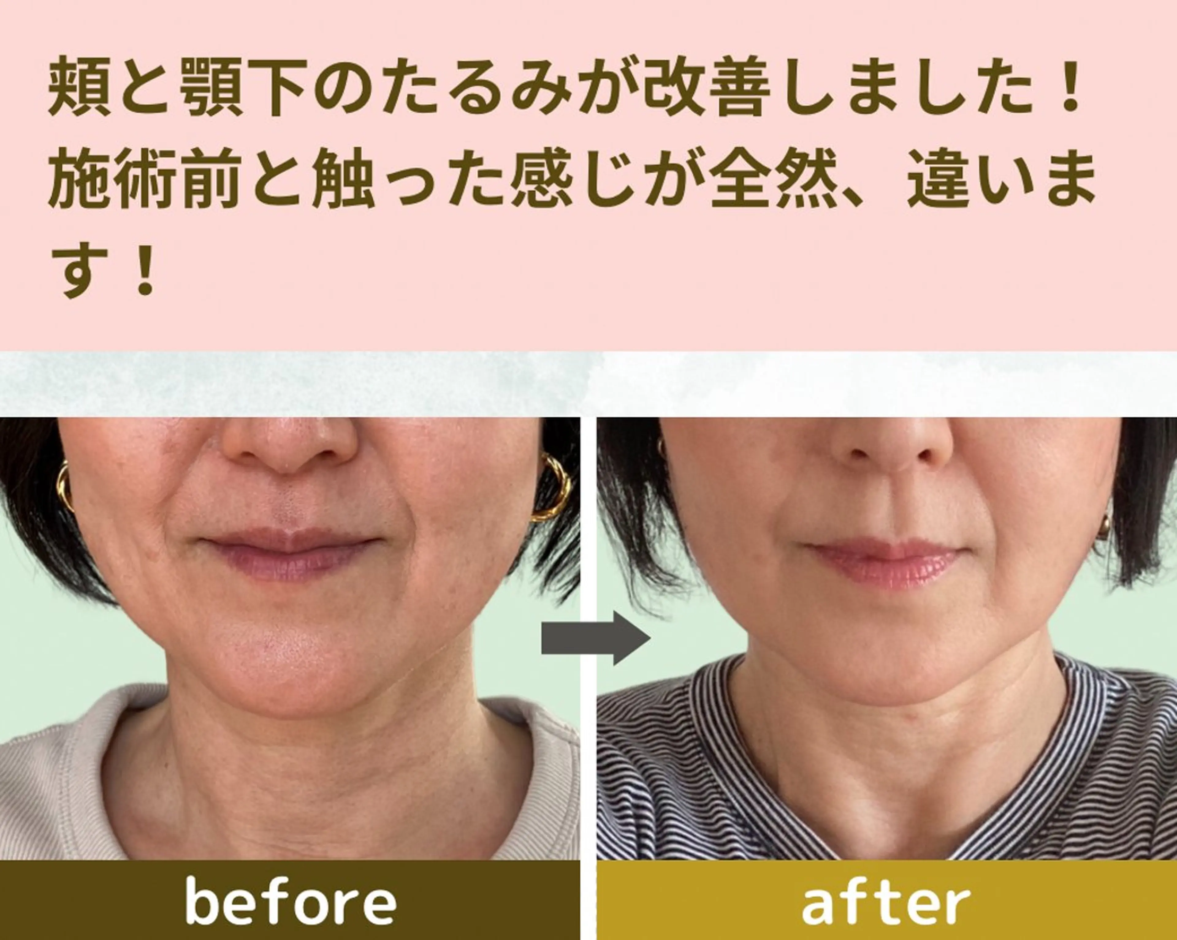 エステ リラク ヘイワポッド所属・小顔&ヘッドスパ/ もりもとまきみのエステ・リラクイメージ