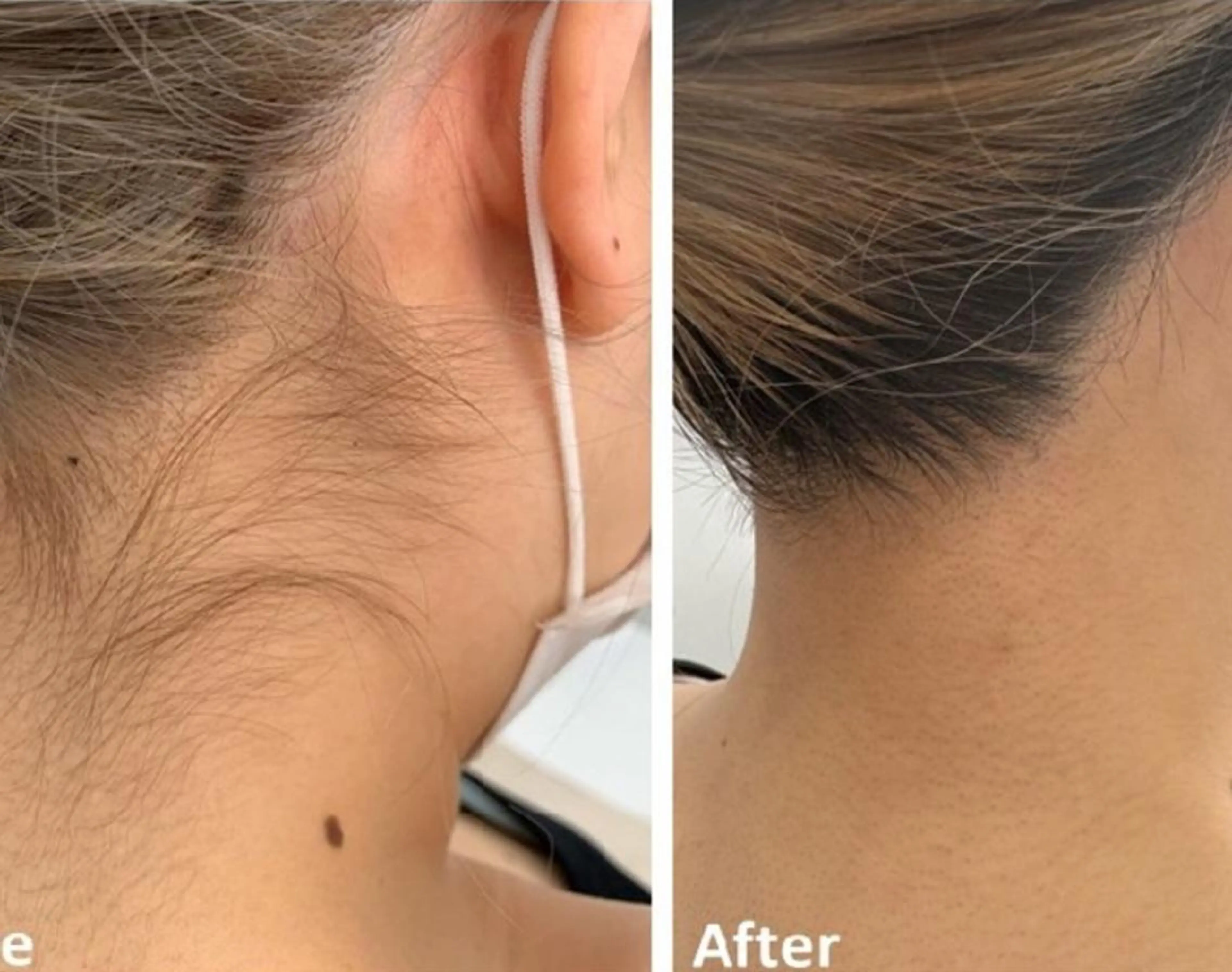 脱毛 男女同額脱毛エステ salonLEPIAのエステ・リラクイメージ