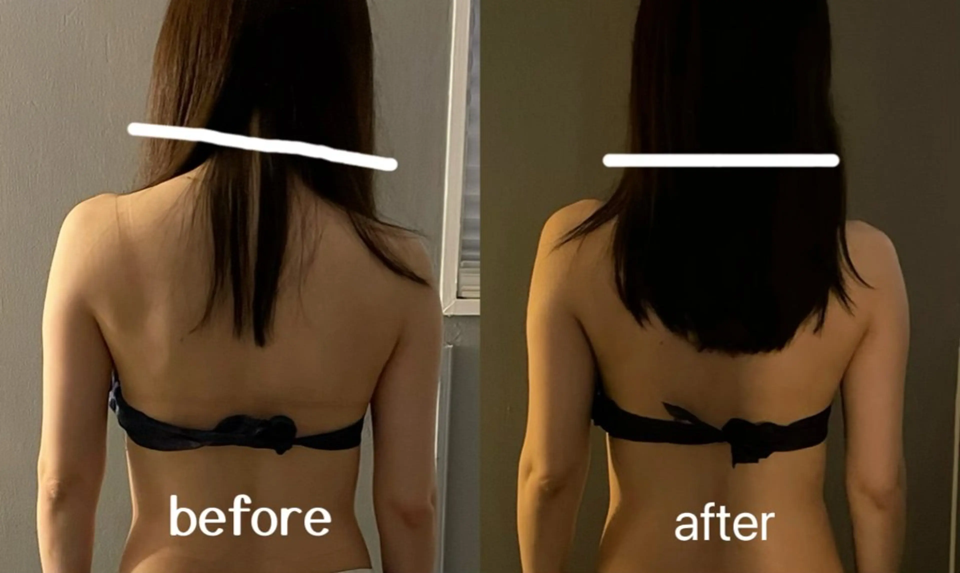 全身痛みの少ない筋膜リリースの写真