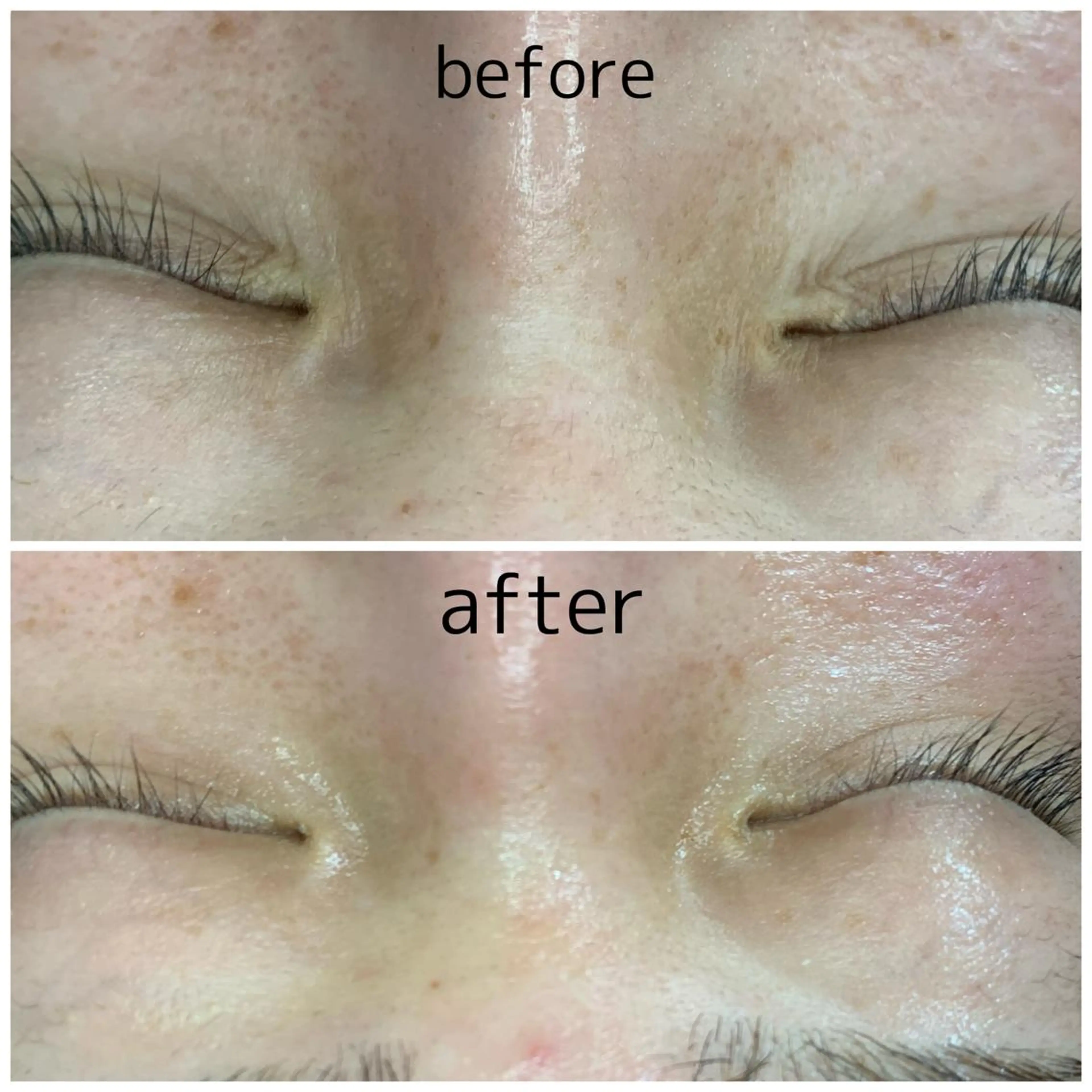 ビューティーサロンLEMO所属・ビューティーサロン Lemoのエステ・リラクイメージ