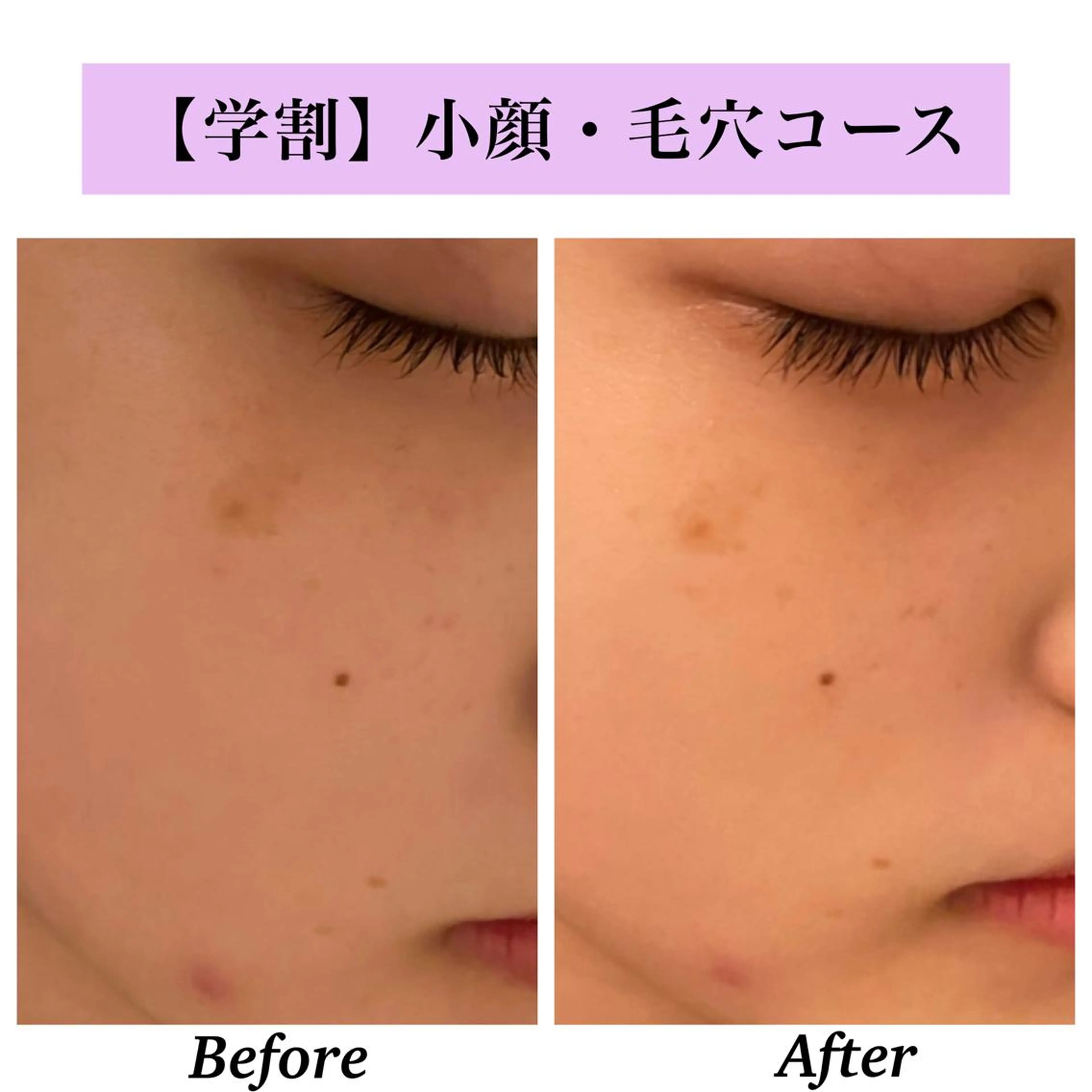 Bellesthe （ベルエステ）のエステ・リラクイメージ