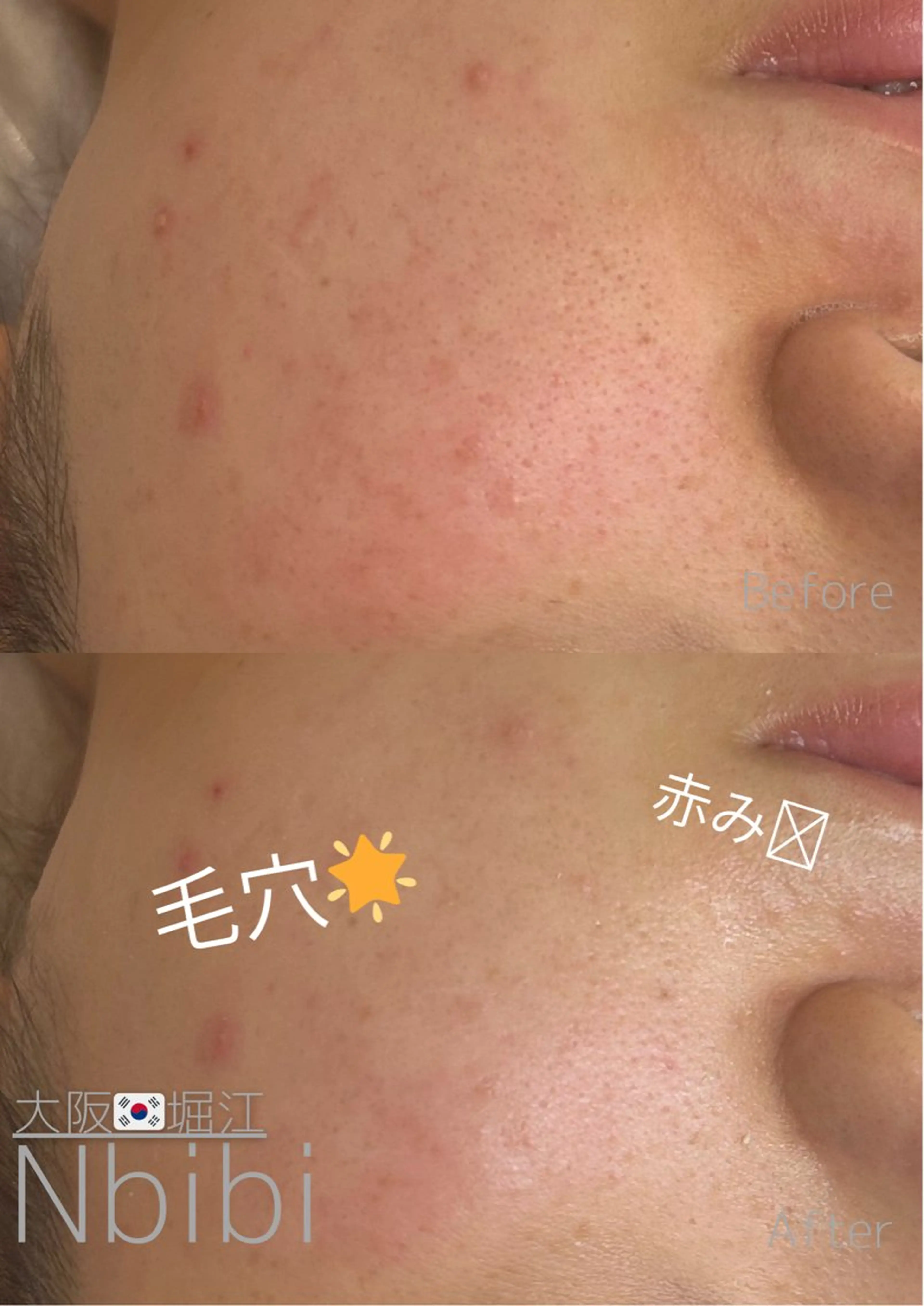 エステ 韓国🇰🇷価格 サロン_Nbibiのエステ・リラクイメージ