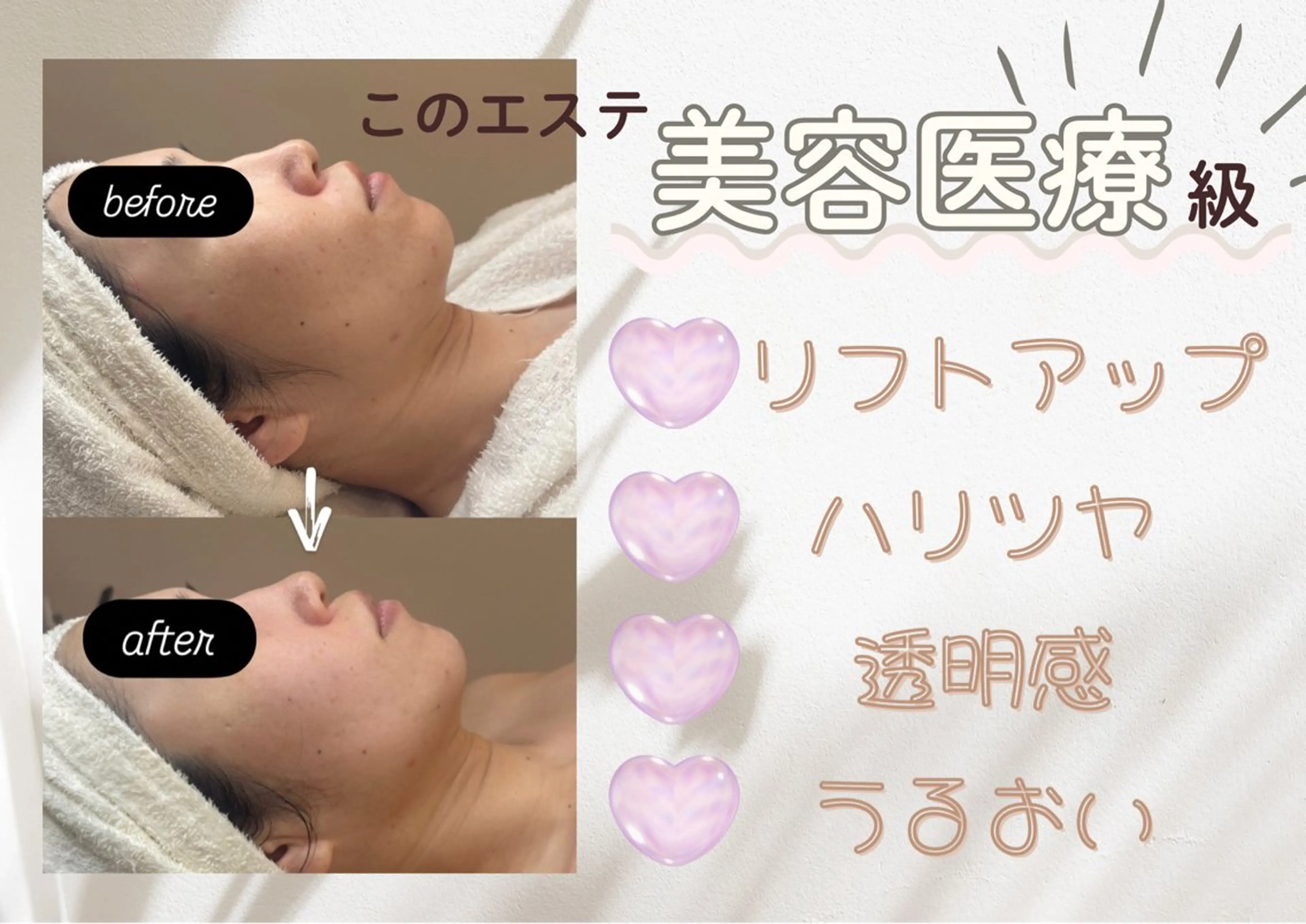 エステ リラク POLA THE BEAUTY 堺東店所属・肌管理🌿毛穴改善 POLA堺東のエステ・リラクイメージ