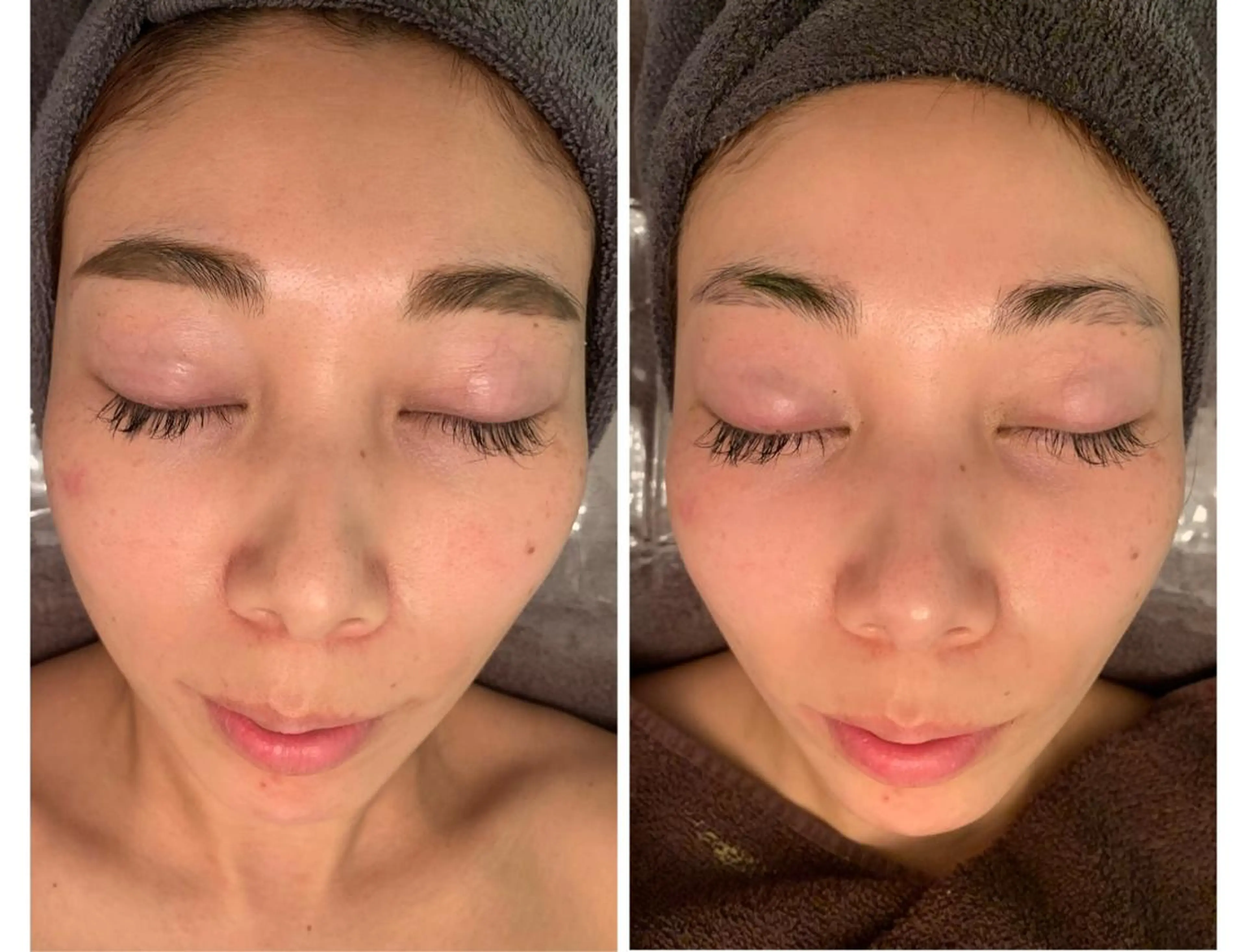 食べながら魅せボディ éclatJua川越のエステ・リラクイメージ