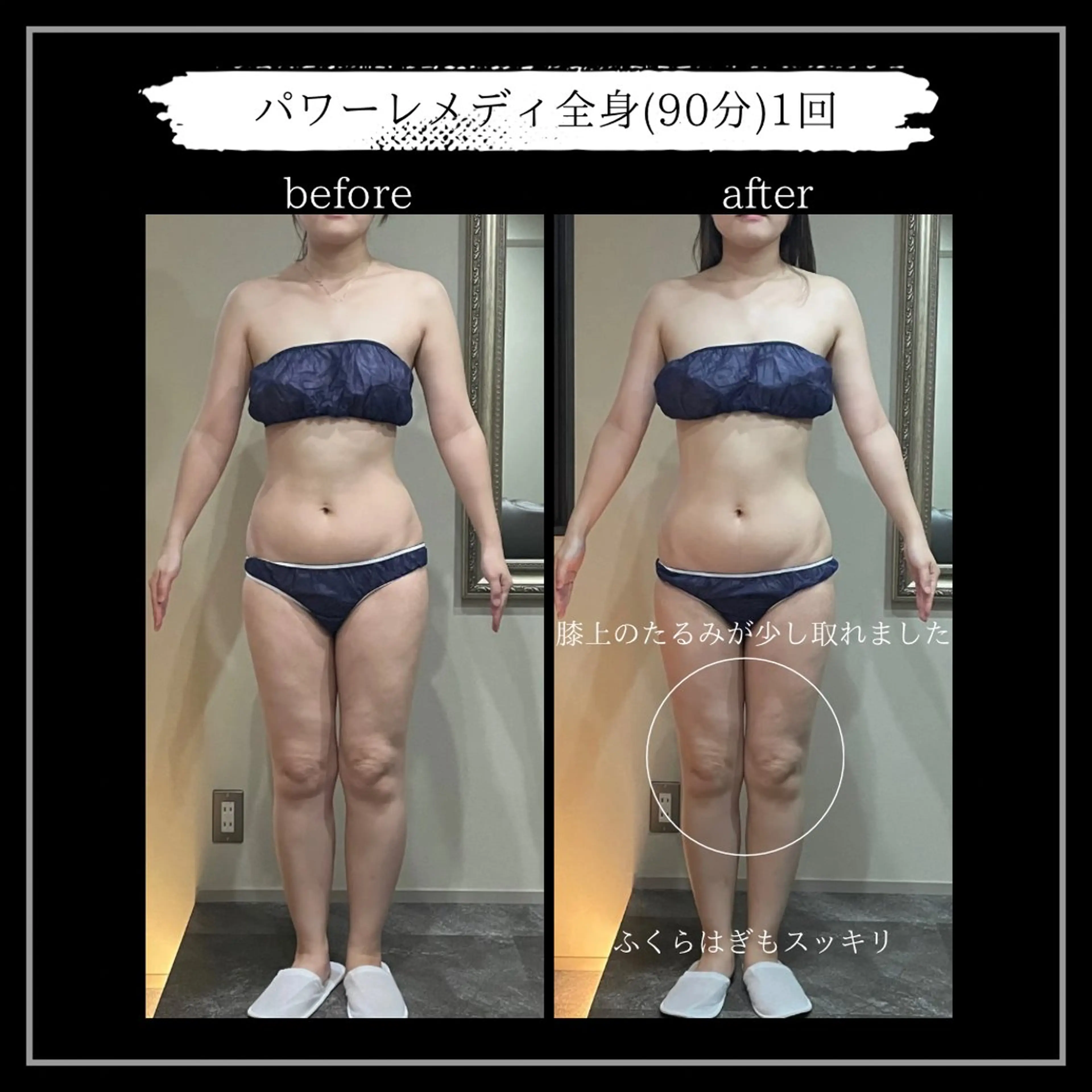 オフ:オン所属・オフ:オン 全身筋膜マッサージのエステ・リラクイメージ