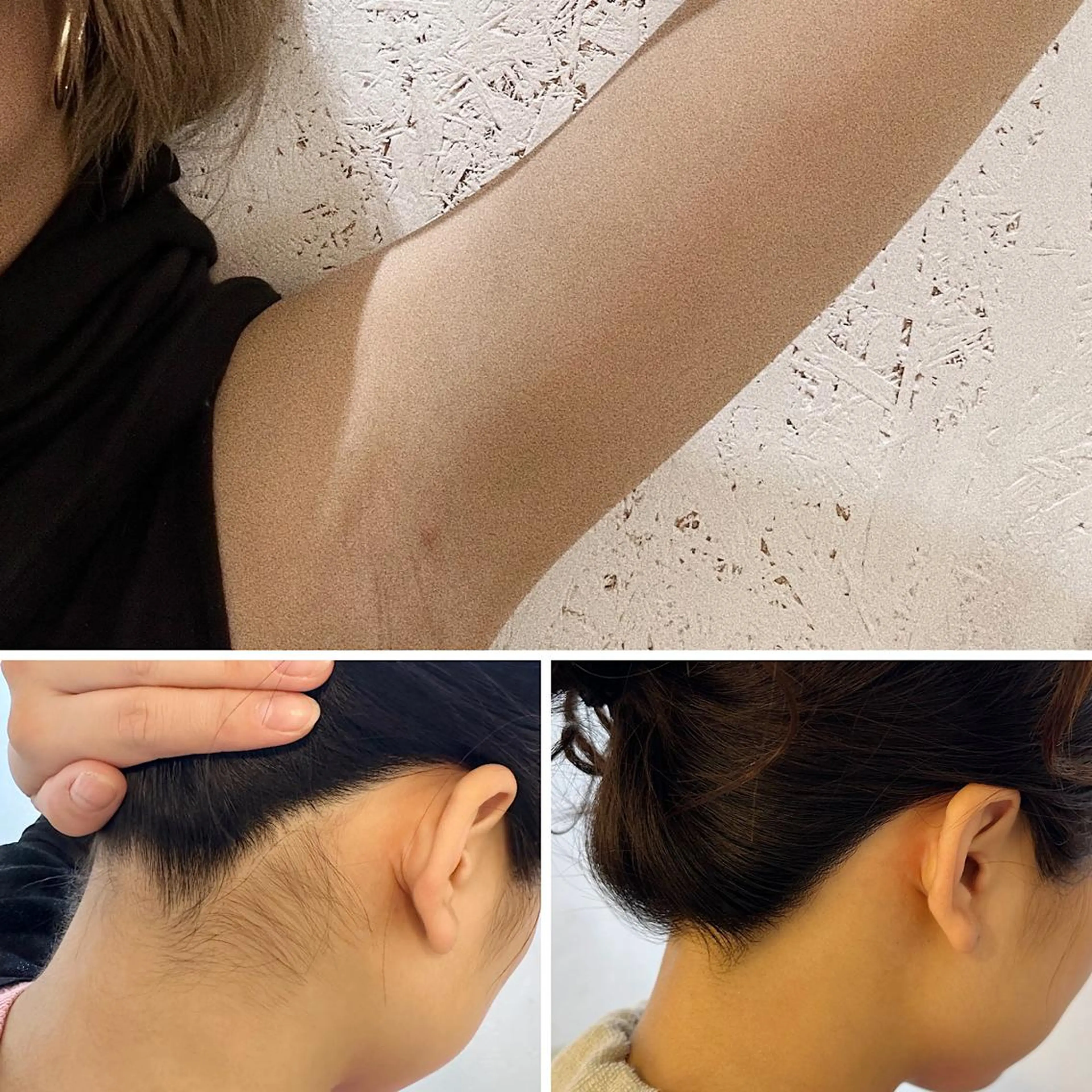 『うなじ✕脇(ワキ)(シェービング付)』迷ってしまった時はこのメニュー🍭ᯓ★「45分」の写真