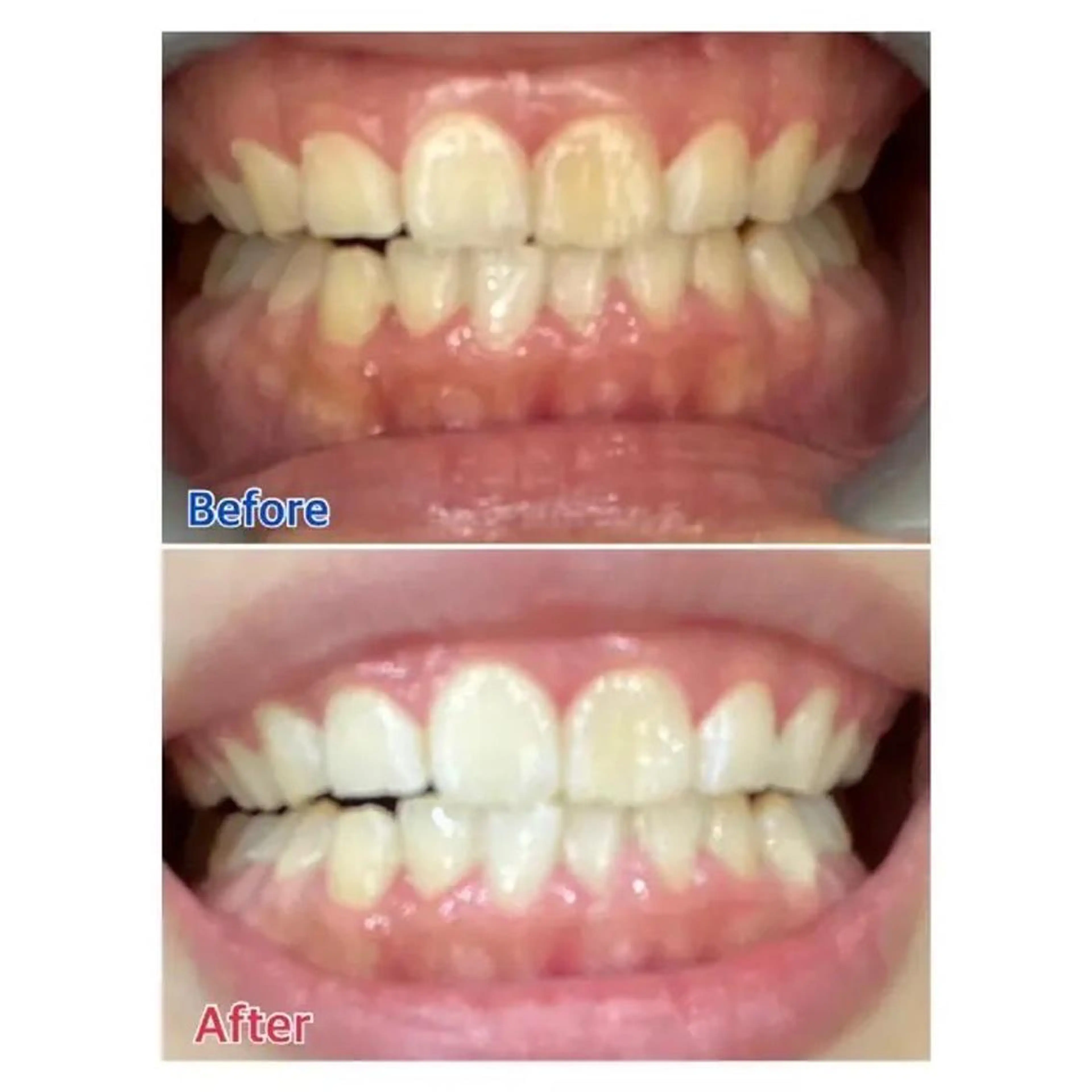 M渋谷店所属・M渋谷 ホワイトニングのエステ・リラクイメージ