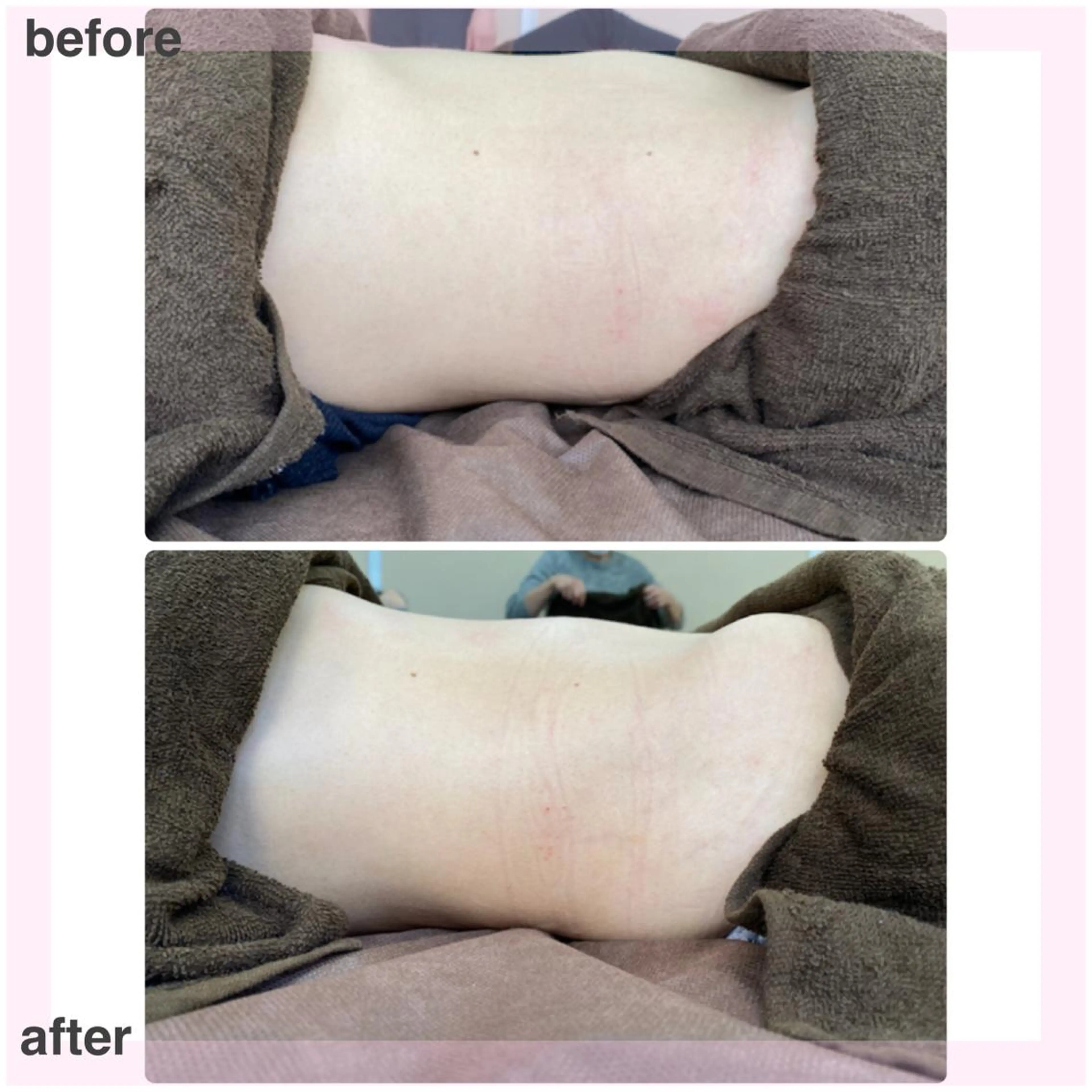 エステ cocorire インターパークの眉毛・アイブロウイメージ