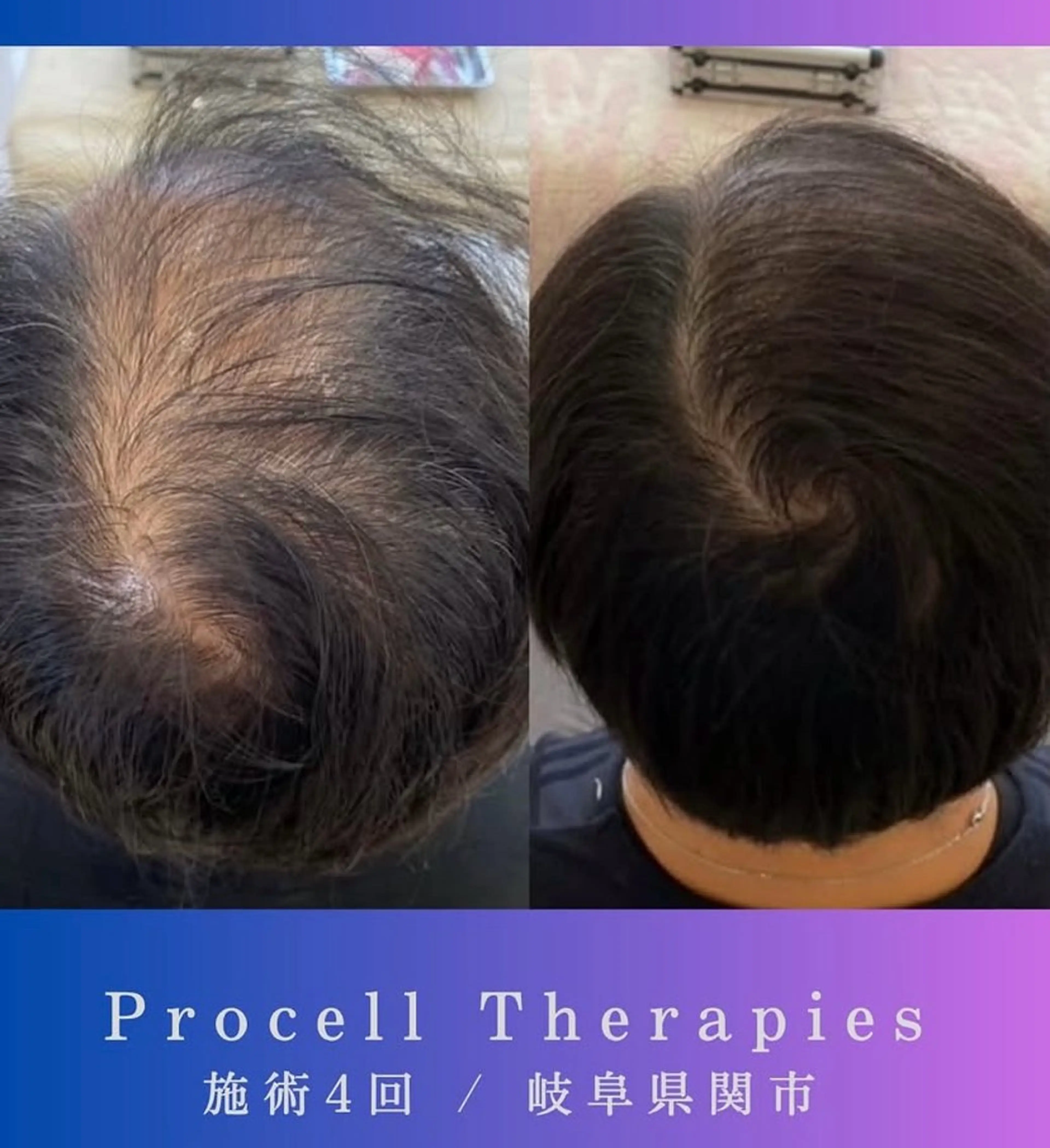 その他 氣楽所属・松下 さゆりのエステ・リラクイメージ