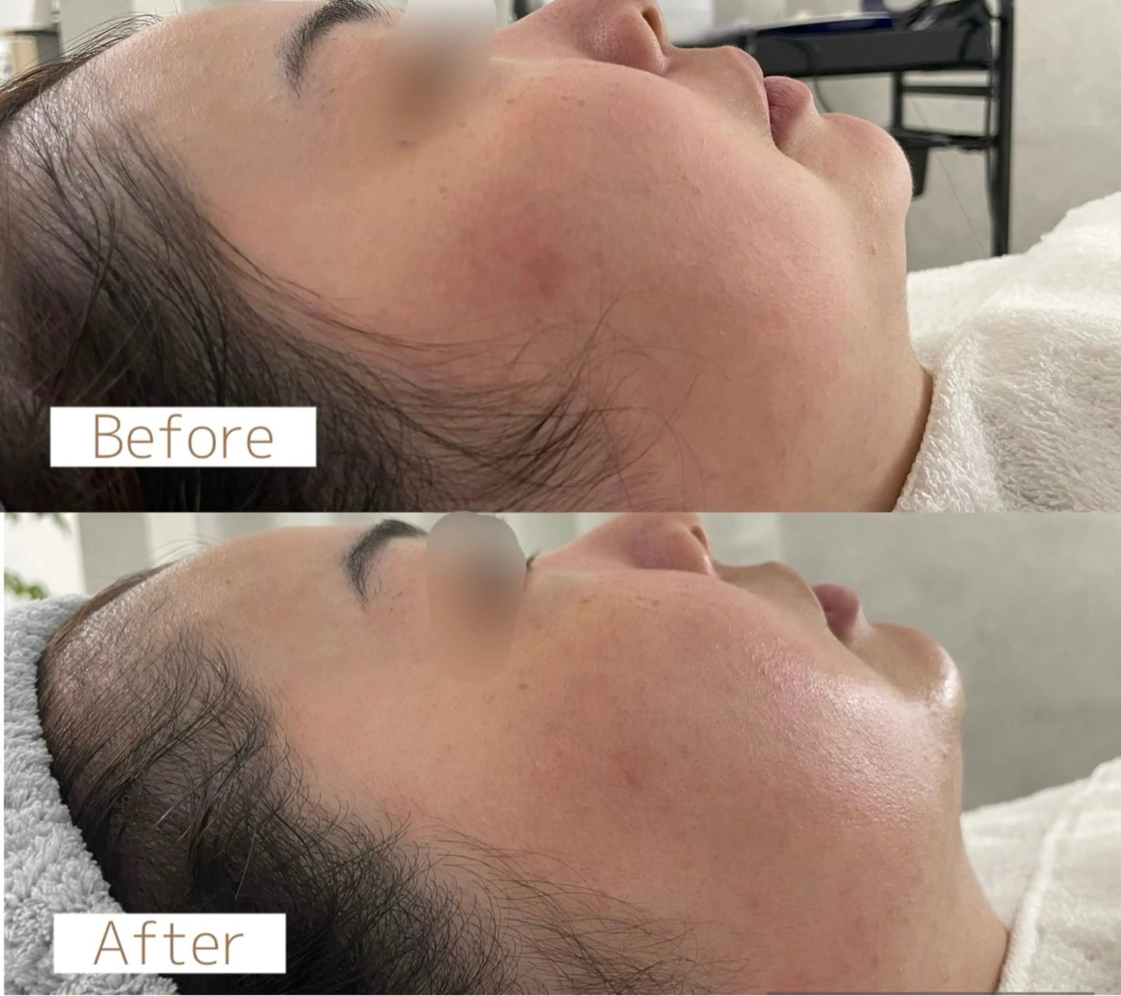 フェイシャル専門サロ  Belchicベルシック所属・Belchic ベルシックのエステ・リラクイメージ