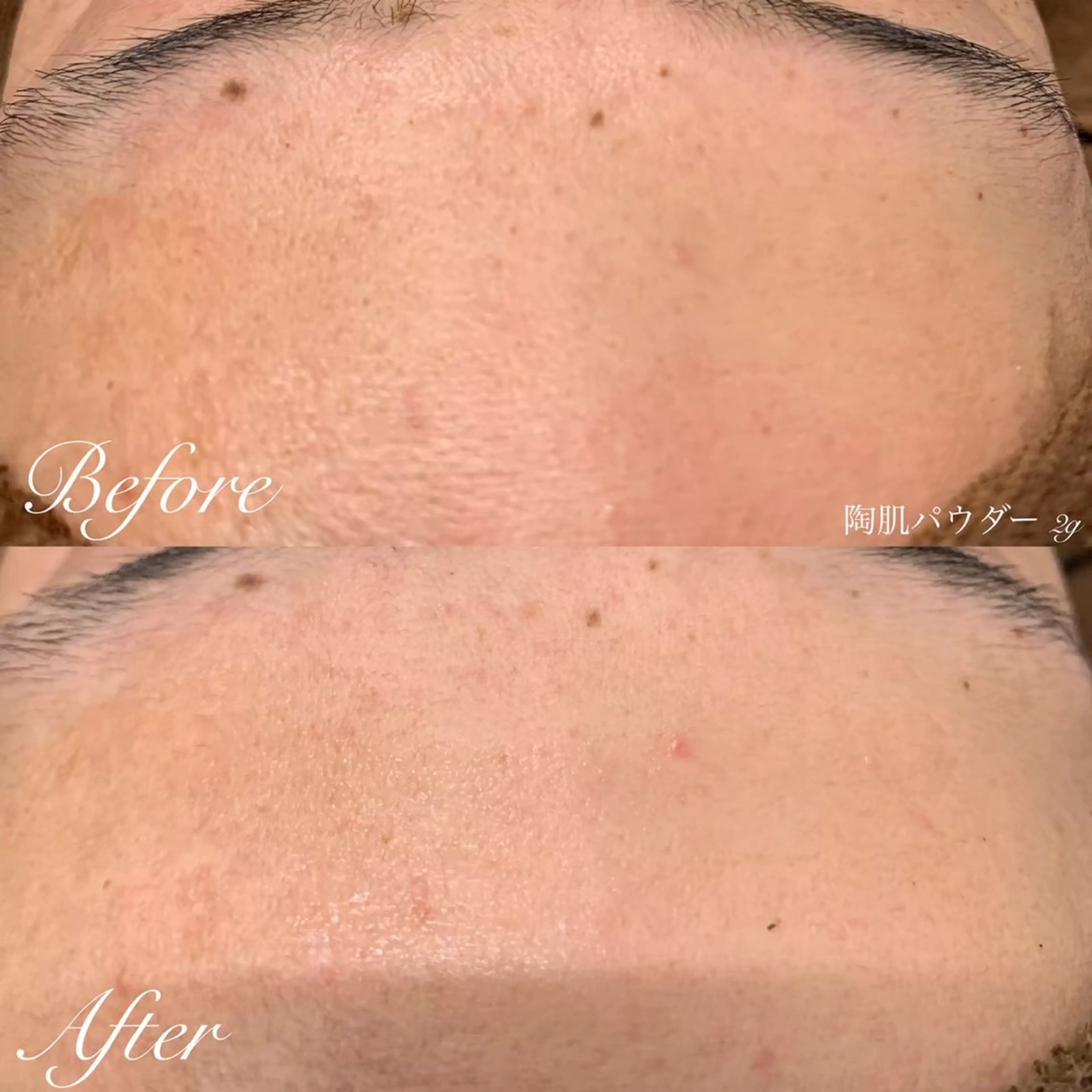 one day所属・肌質改善ハーブサロン ALA原宿のエステ・リラクイメージ