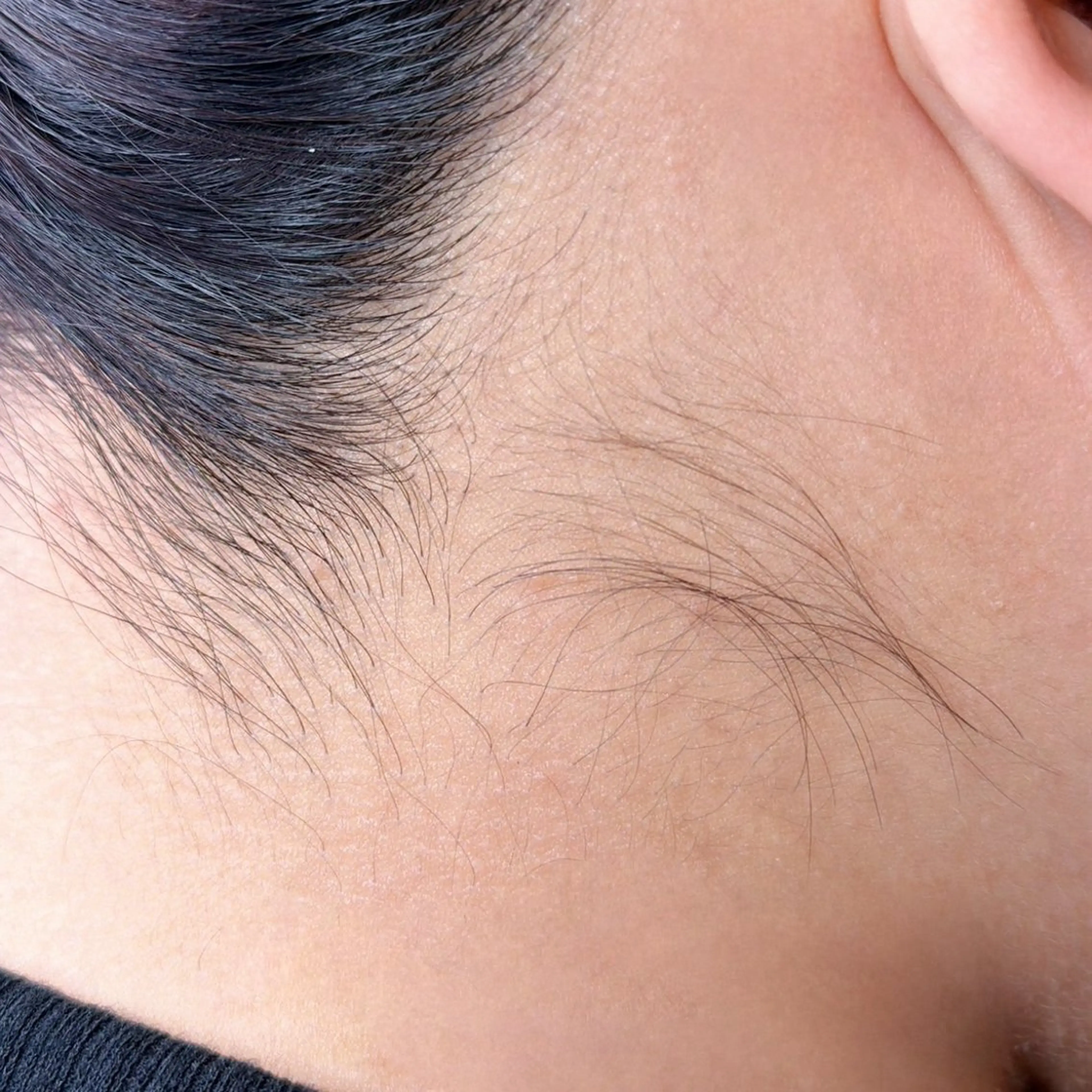 脱毛 FENICE  total beauty salon所属・takii chikaのエステ・リラクイメージ