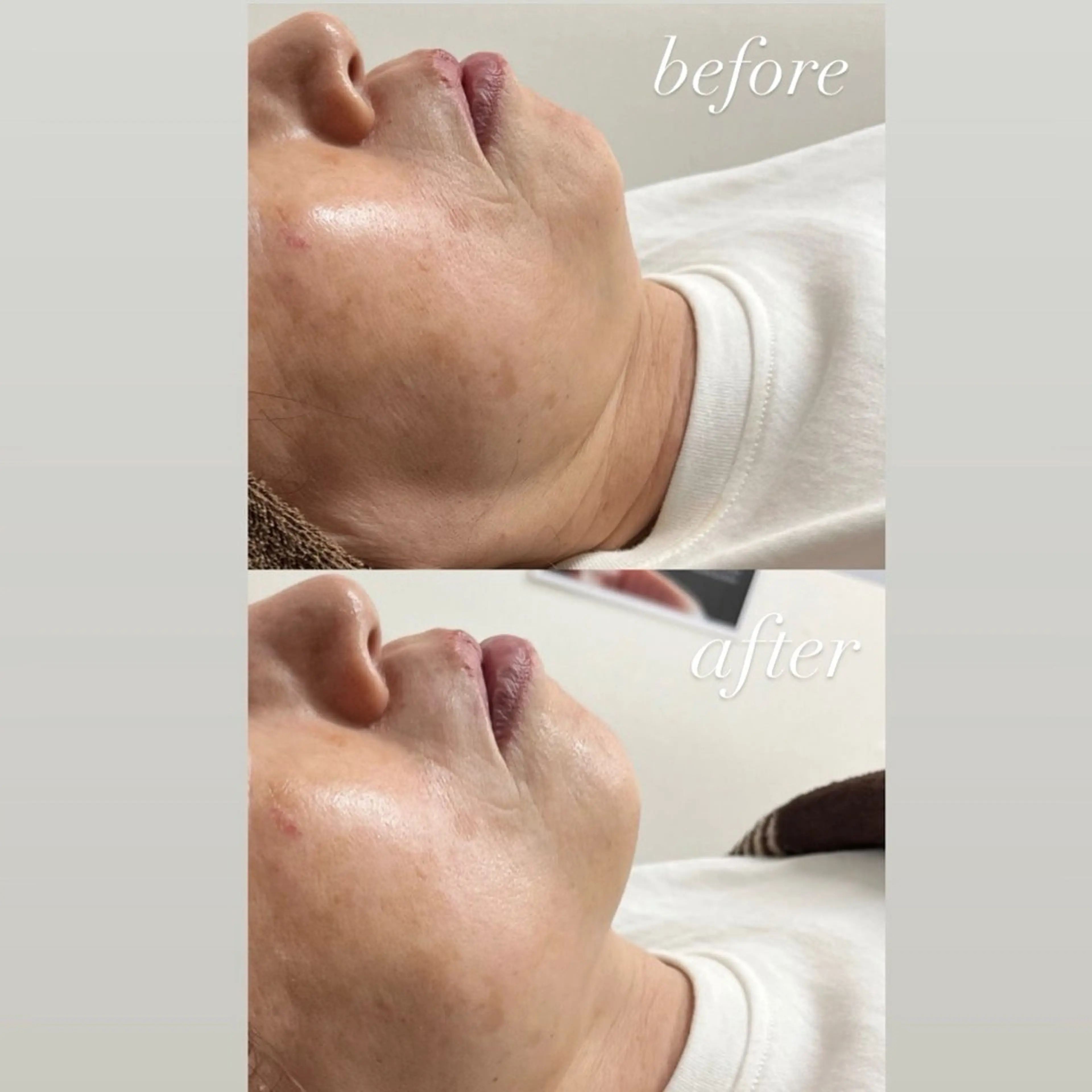 その他 smileskin 京都／meguのその他イメージ