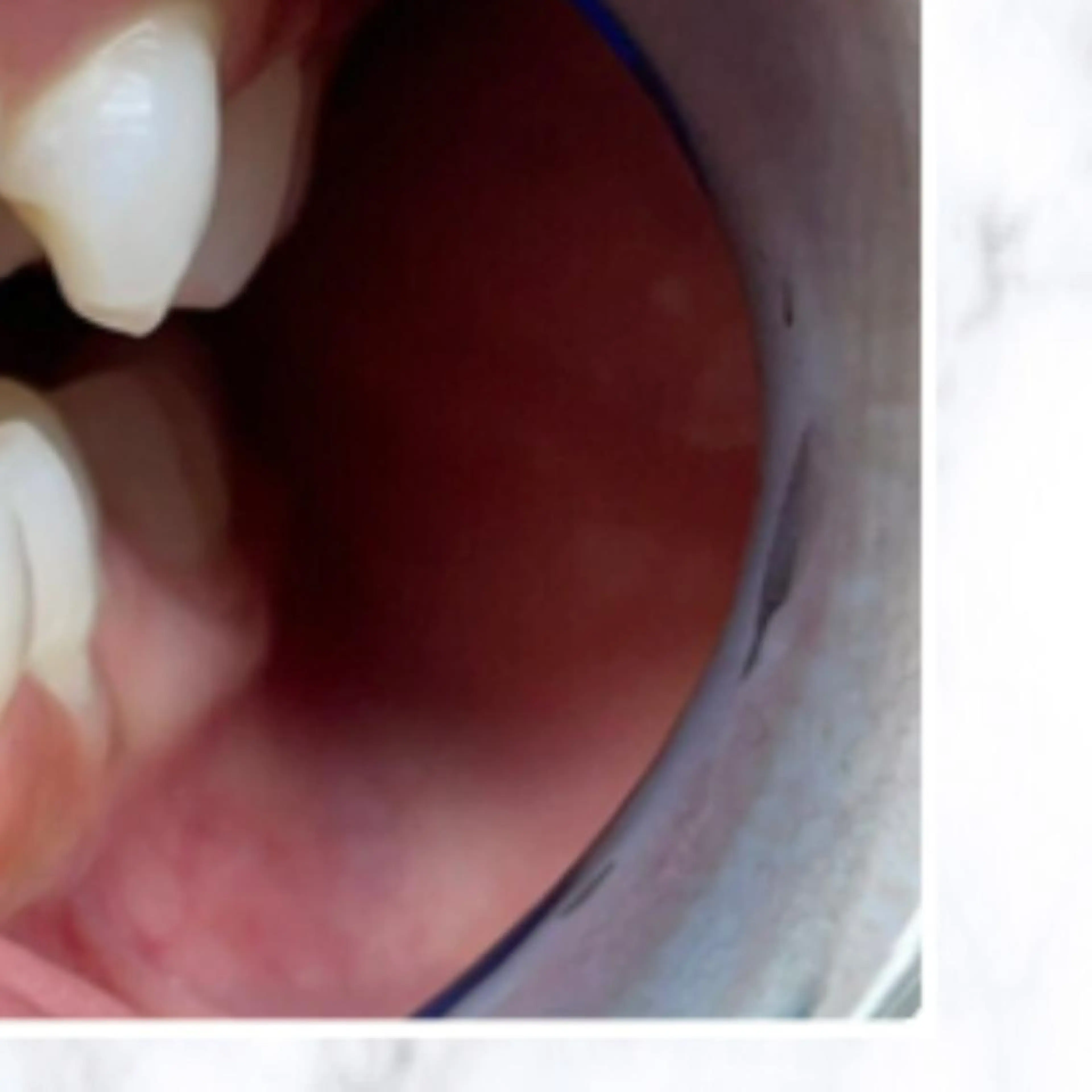 その他 ライトケアサロン 渋谷店② 渡邊のその他イメージ