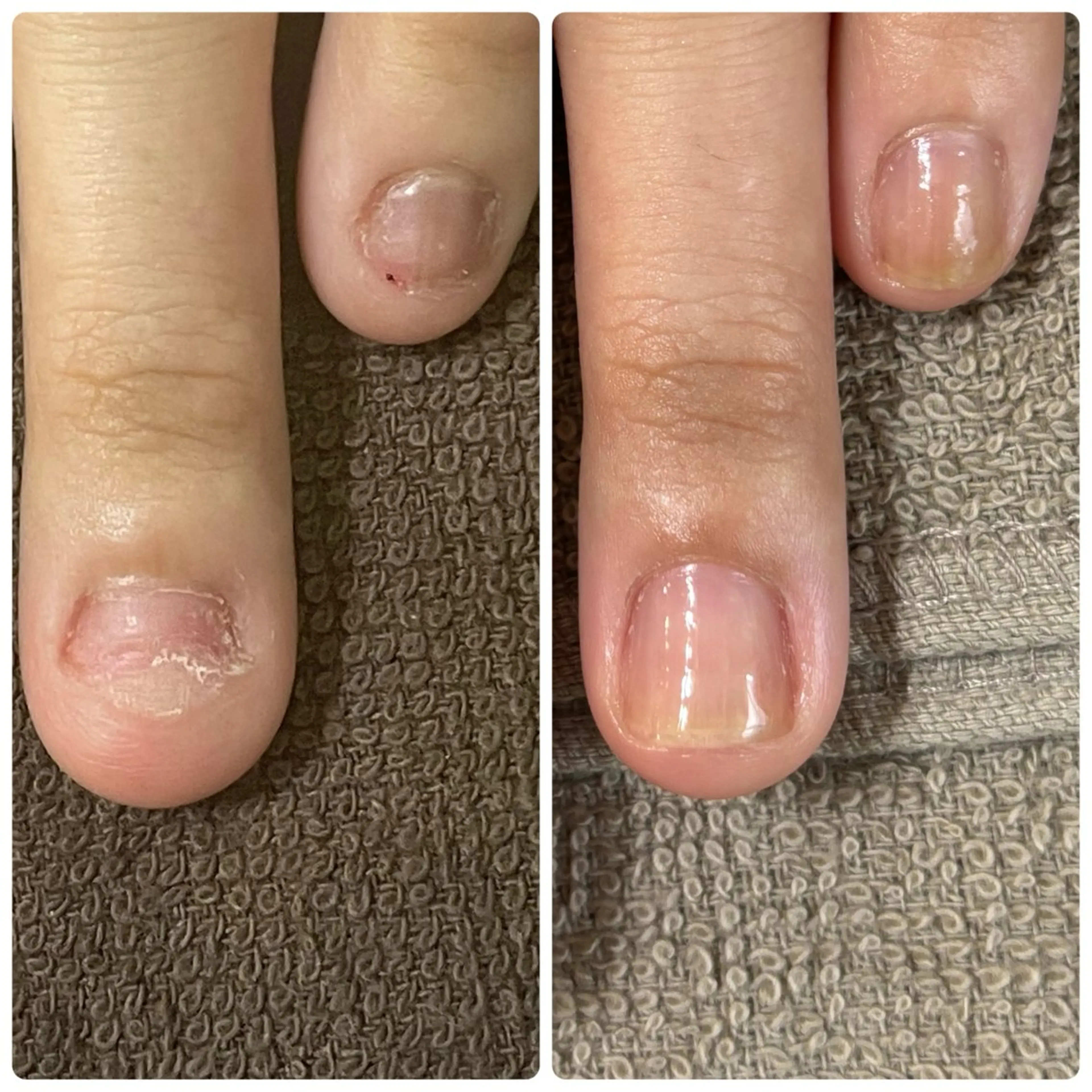 ネイル 自爪育成専門店Ka pilina所属・自爪育成専門店 Kapilinaのエステ・リラクイメージ