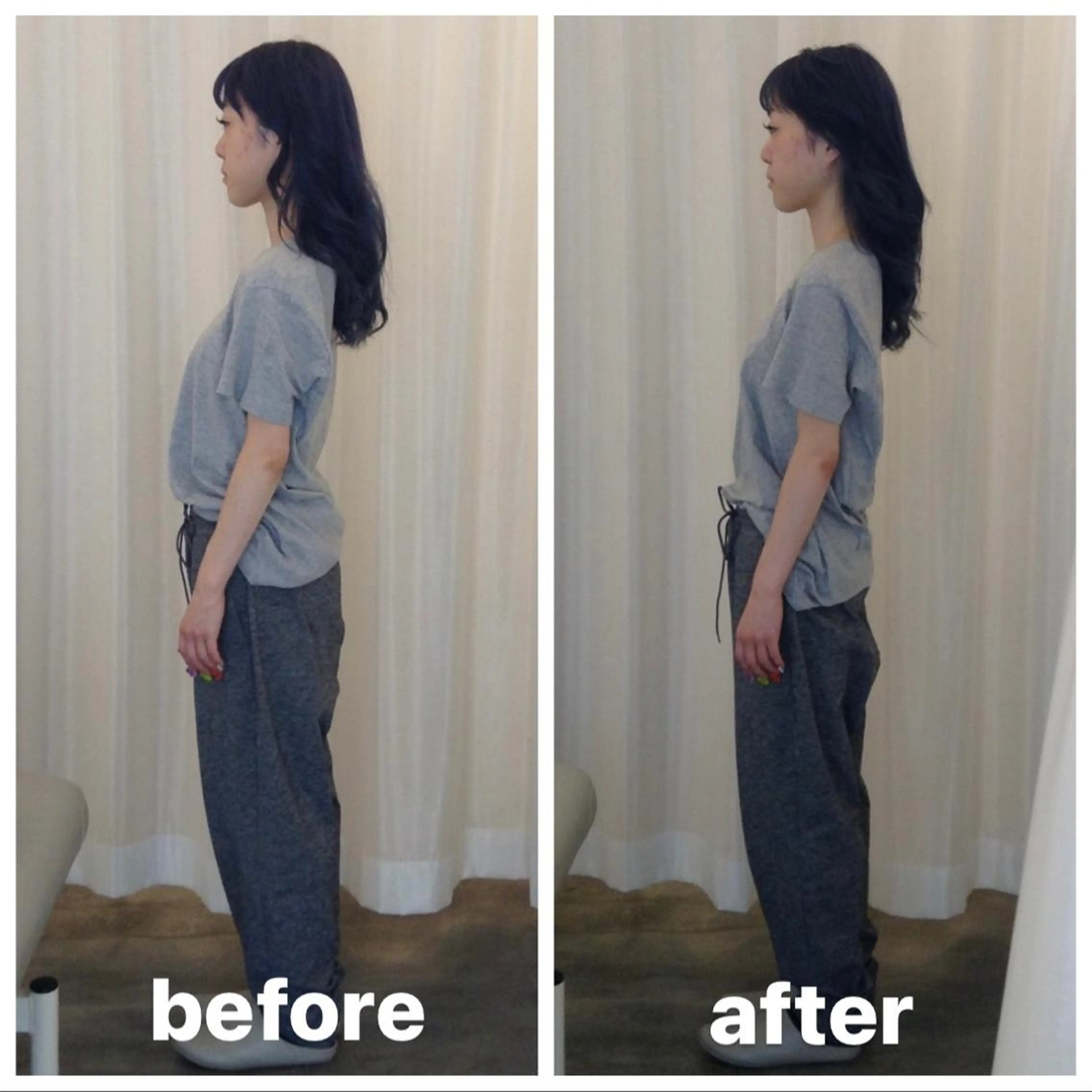 【肩こり・腰痛根本改善】全身オーダーメイド姿勢矯正　【50分17900→3400】の写真