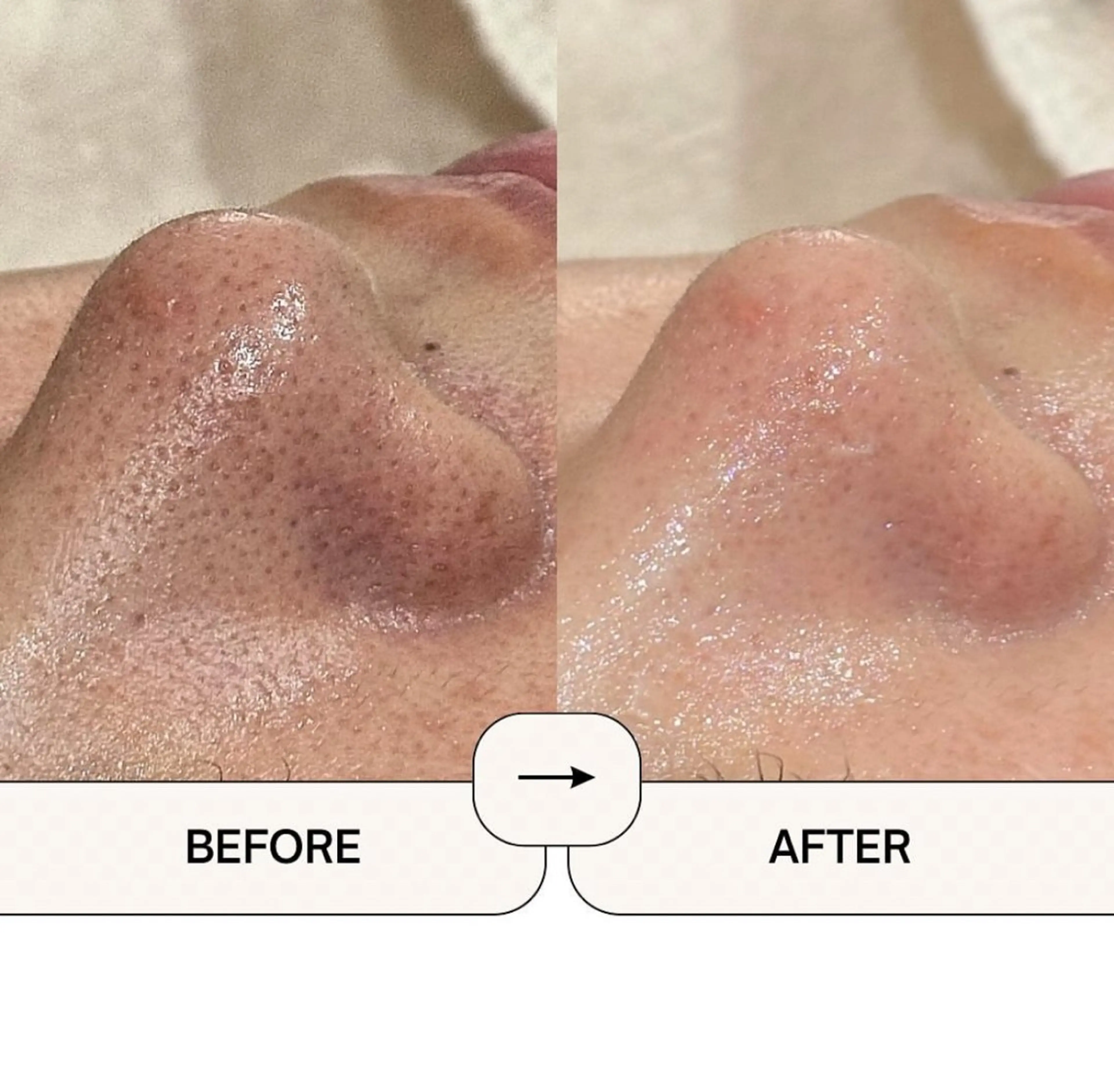 エステ Suu.今池/千種 メンズ眉毛の眉毛・アイブロウイメージ