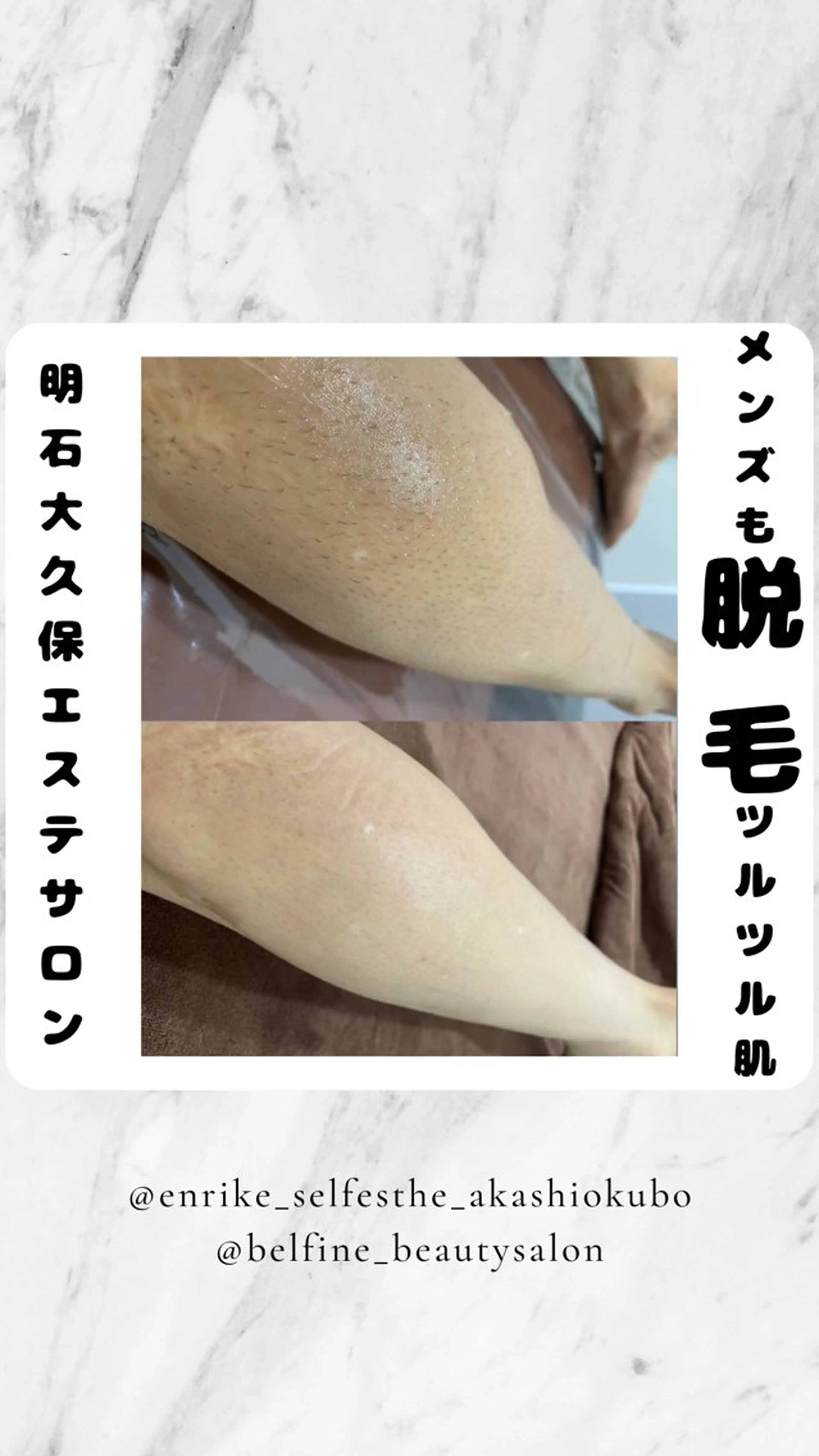 セルフエステエンリケ明石大久保店所属・夕希リンパ&痩身& 脱毛&毛穴ケアのエステ・リラクイメージ