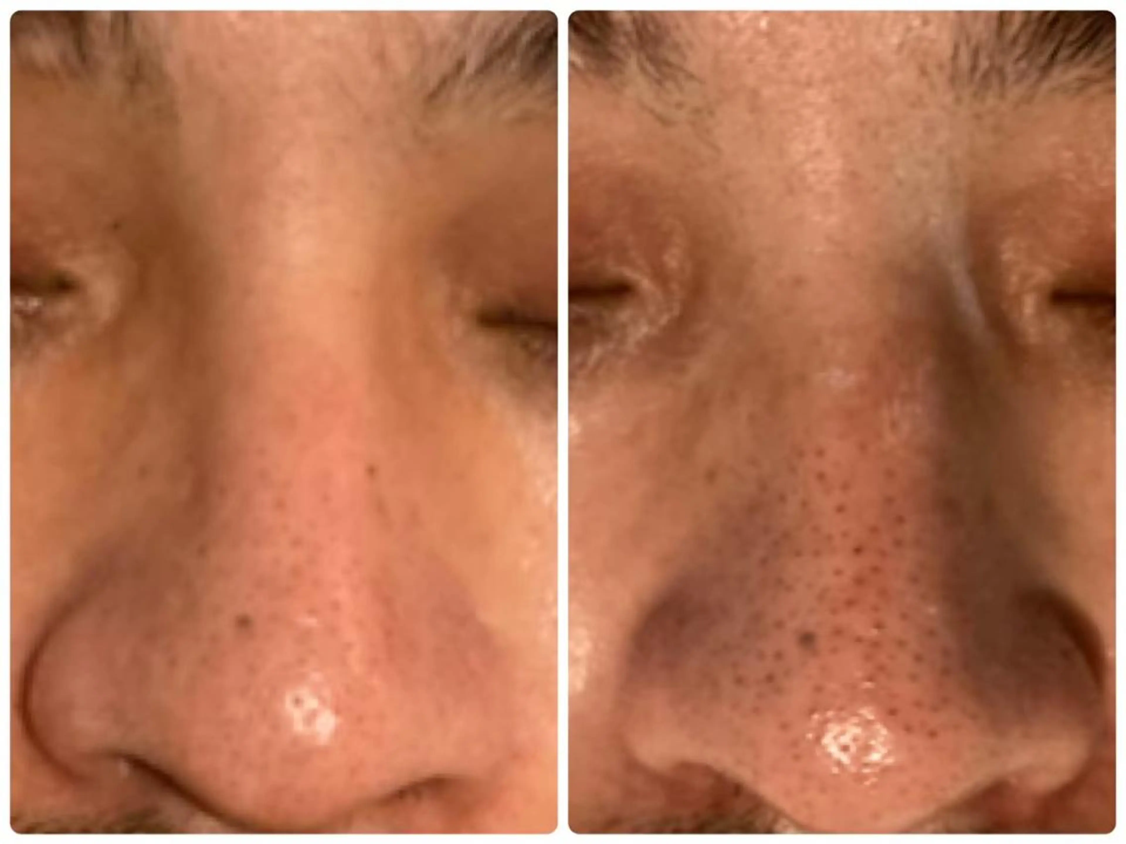 hm NATURESKINのエステ・リラクイメージ