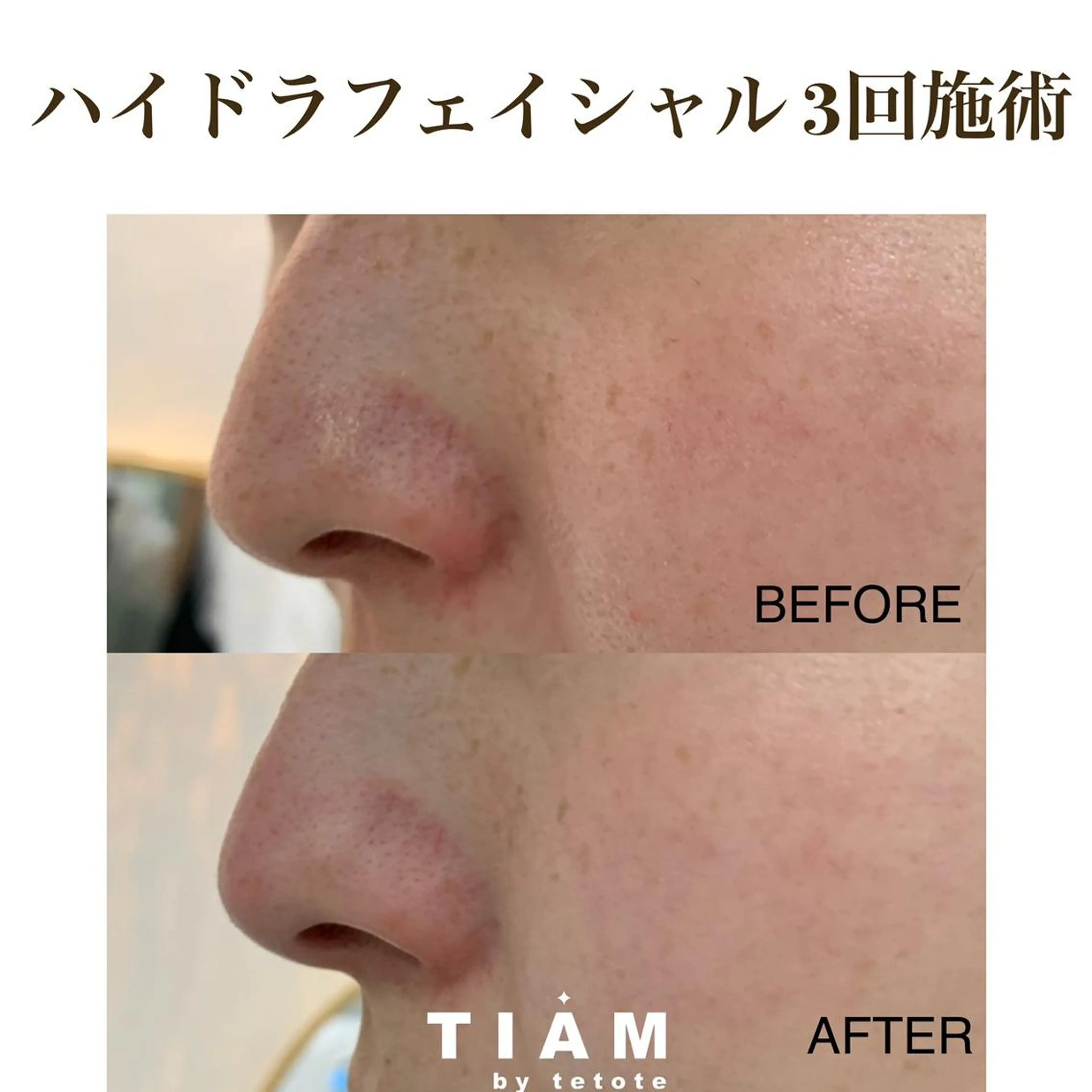 美肌サロンTIAM by tetoteのエステ・リラクイメージ