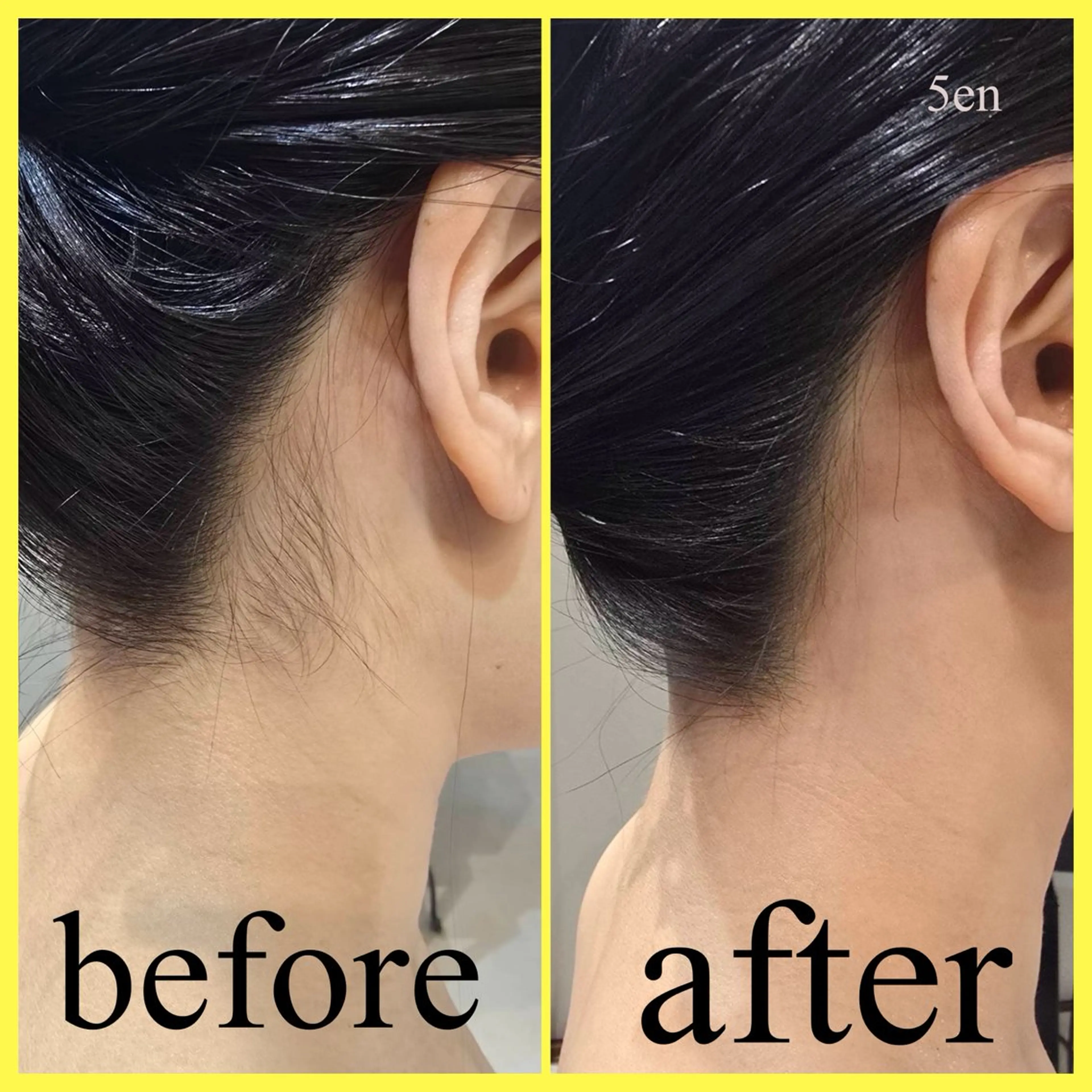 脱毛 シュガーリング/脱毛 EARLS三軒茶屋のエステ・リラクイメージ