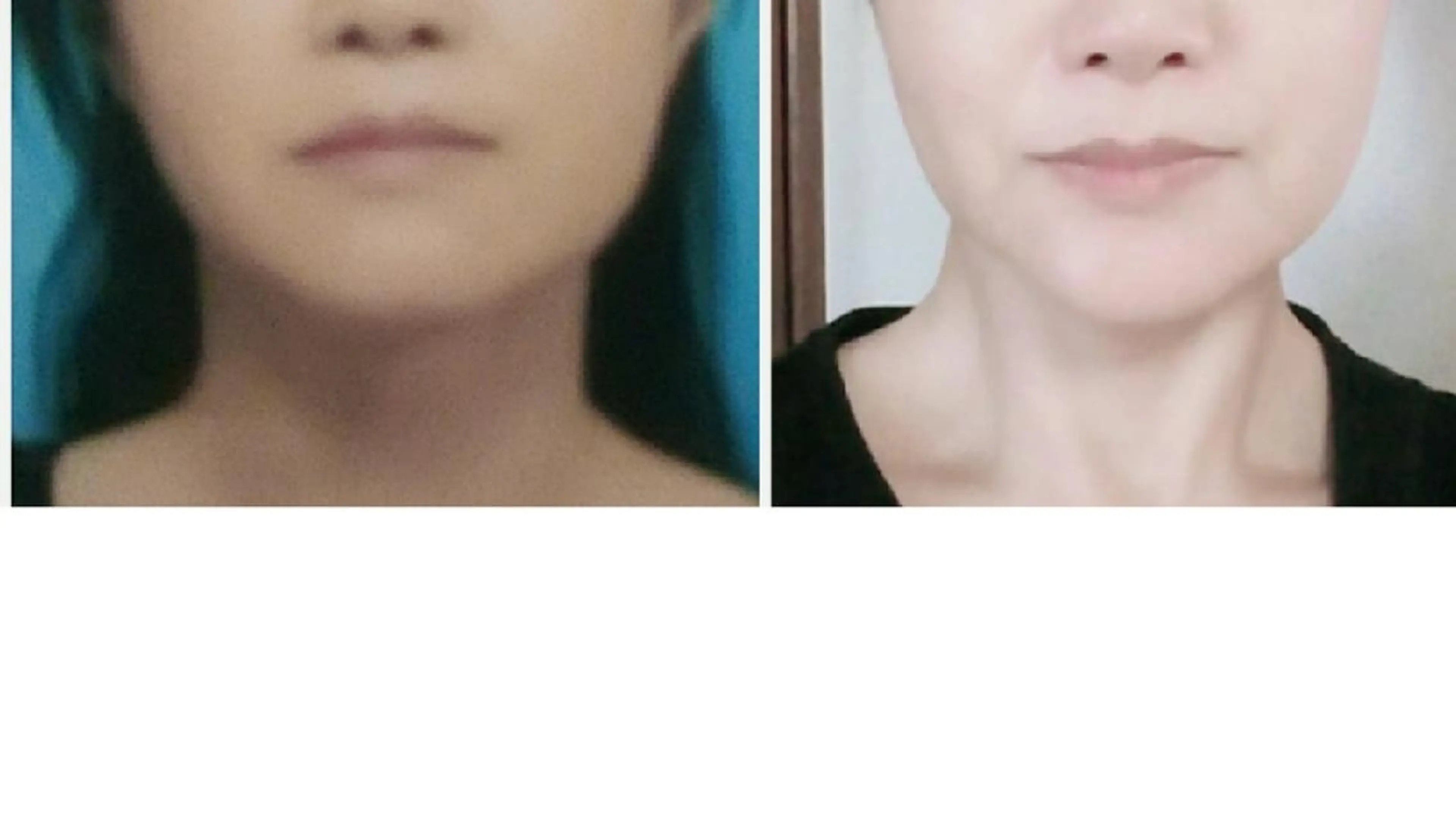 エステ 小顔と美肌 まごころエステMatoria所属・小顔 美肌専門 Matoriaのエステ・リラクイメージ