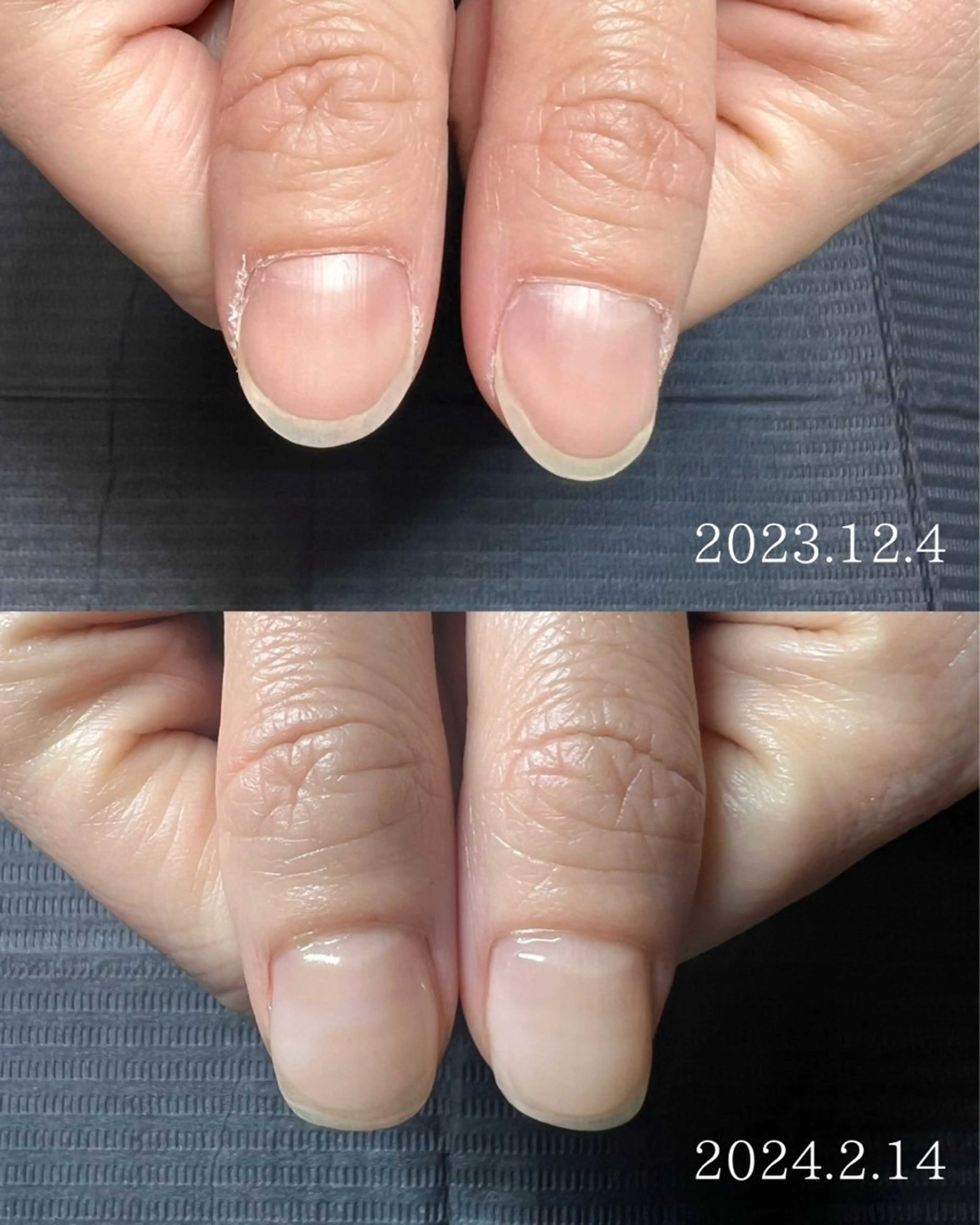 ネイル Unoa nailのネイルデザイン