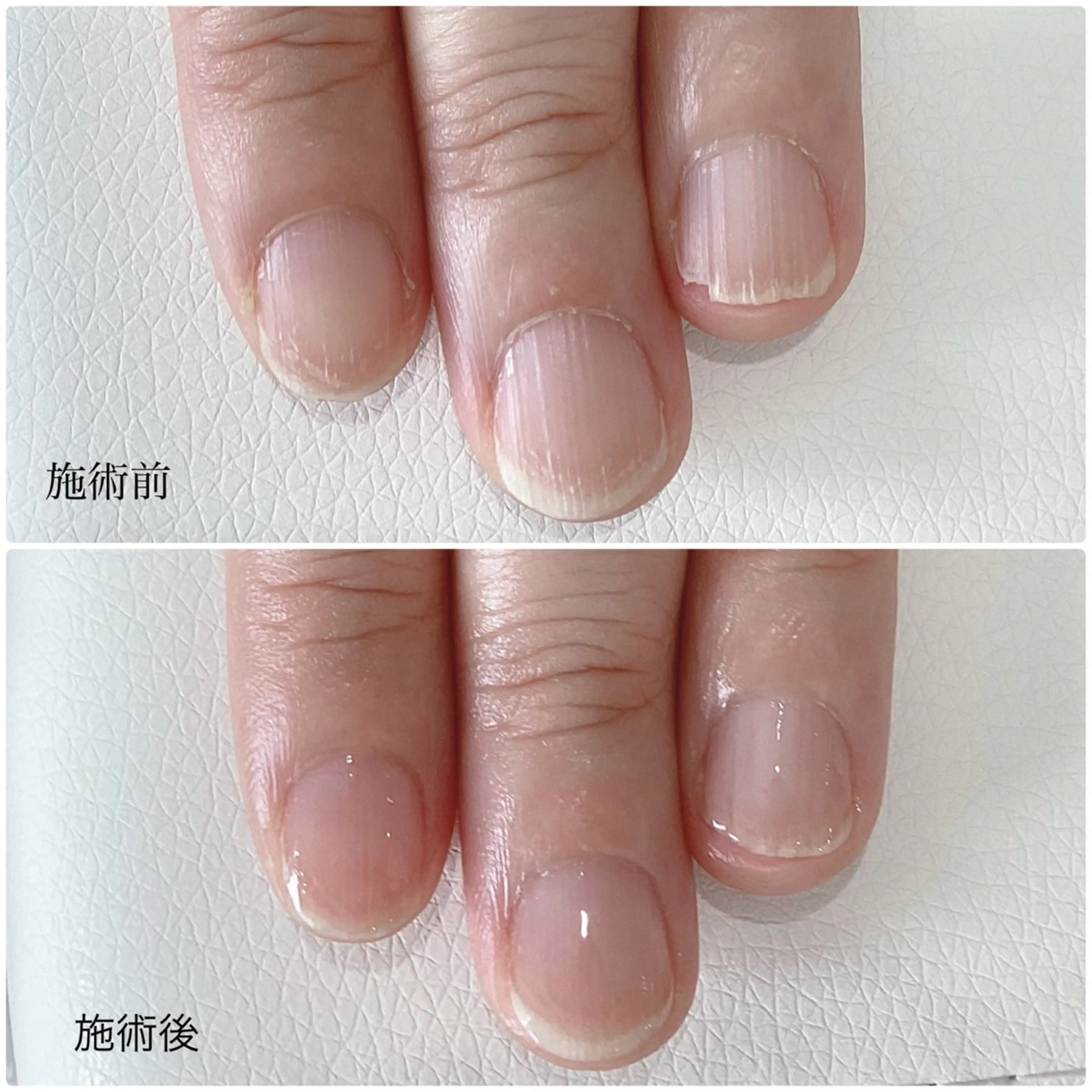 ネイル その他(ネイル) nailcare リリネルのネイルデザイン