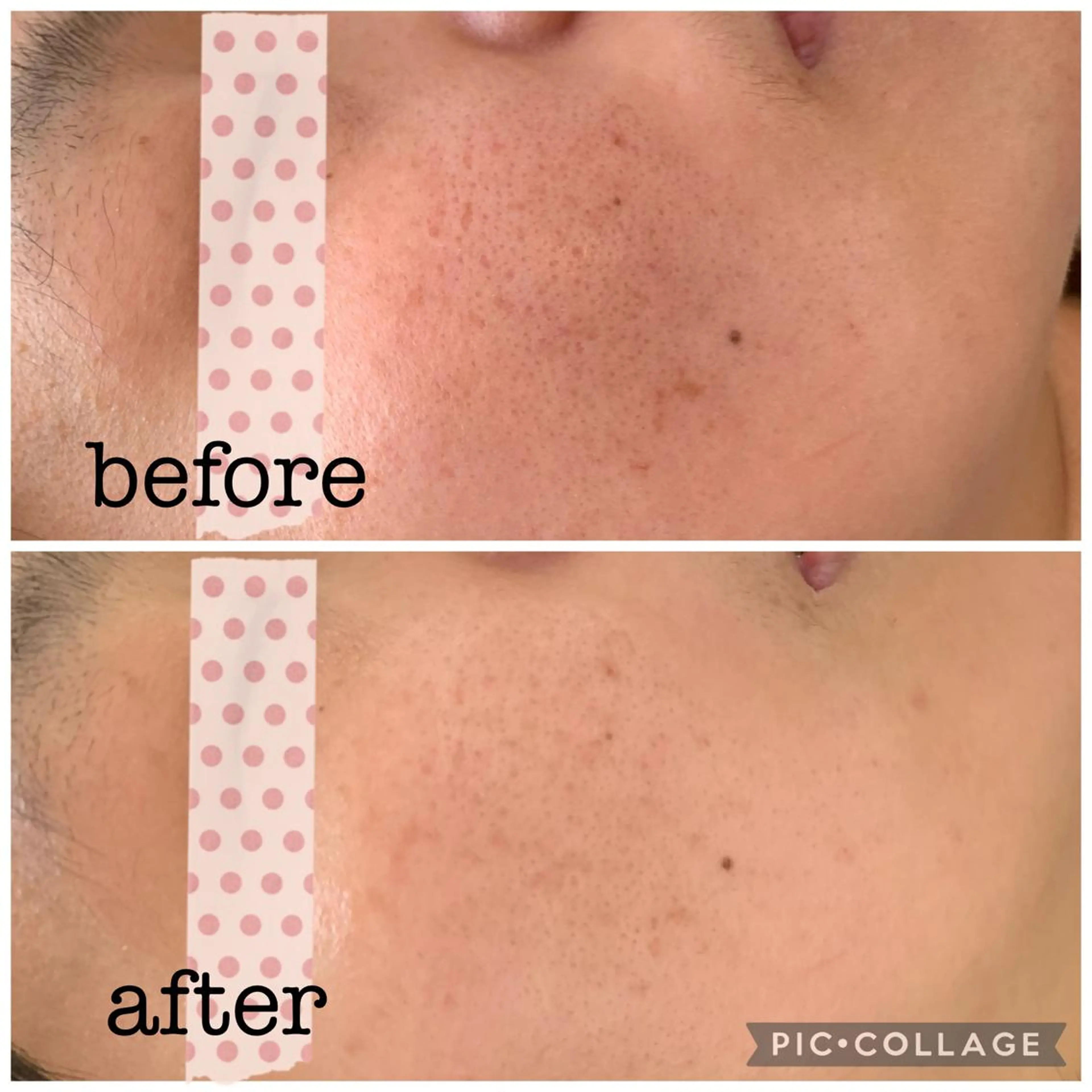 エステ シミケア E Lashのエステ・リラクイメージ