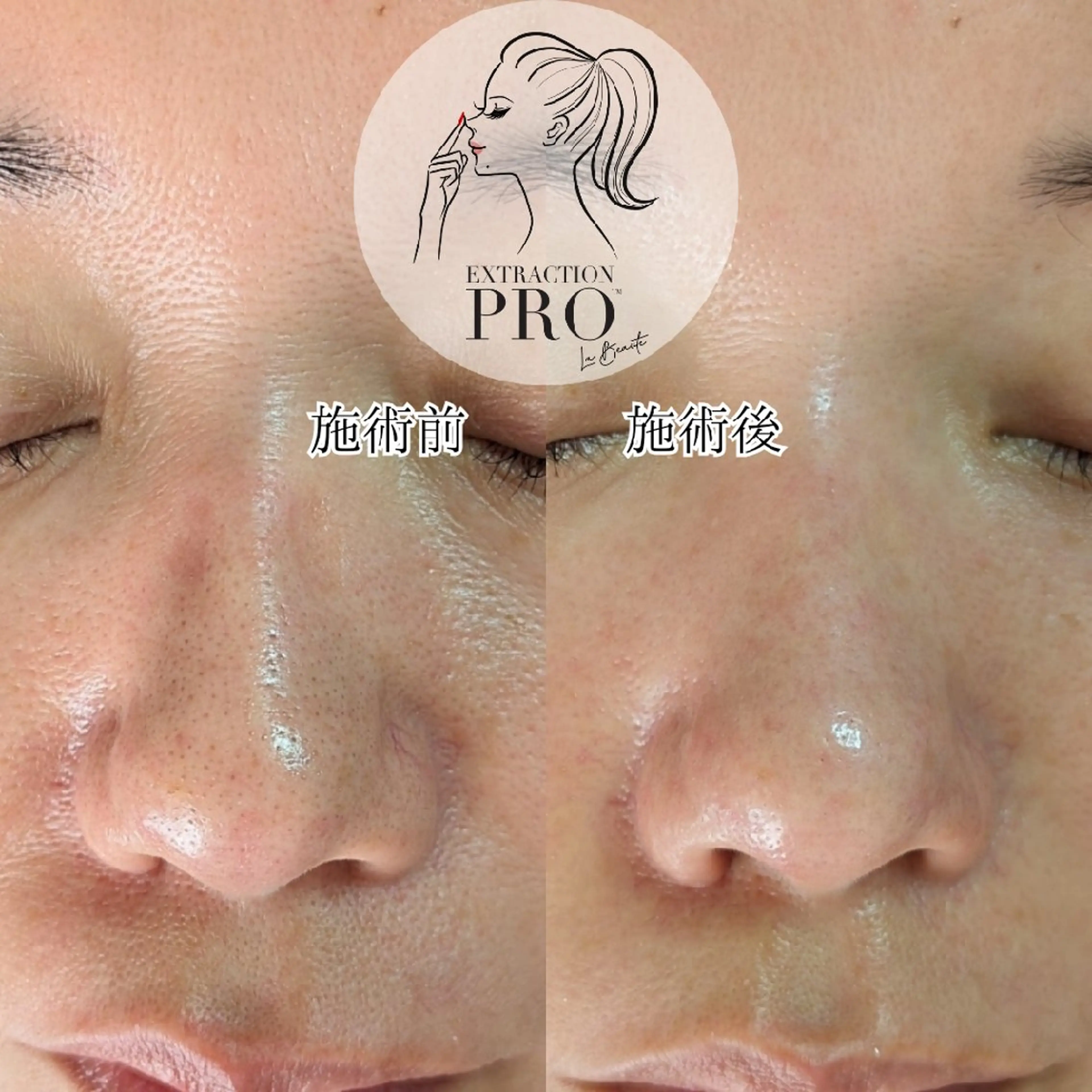  毛穴洗浄・まつ毛 の専門店 ソラーレのエステ・リラクイメージ