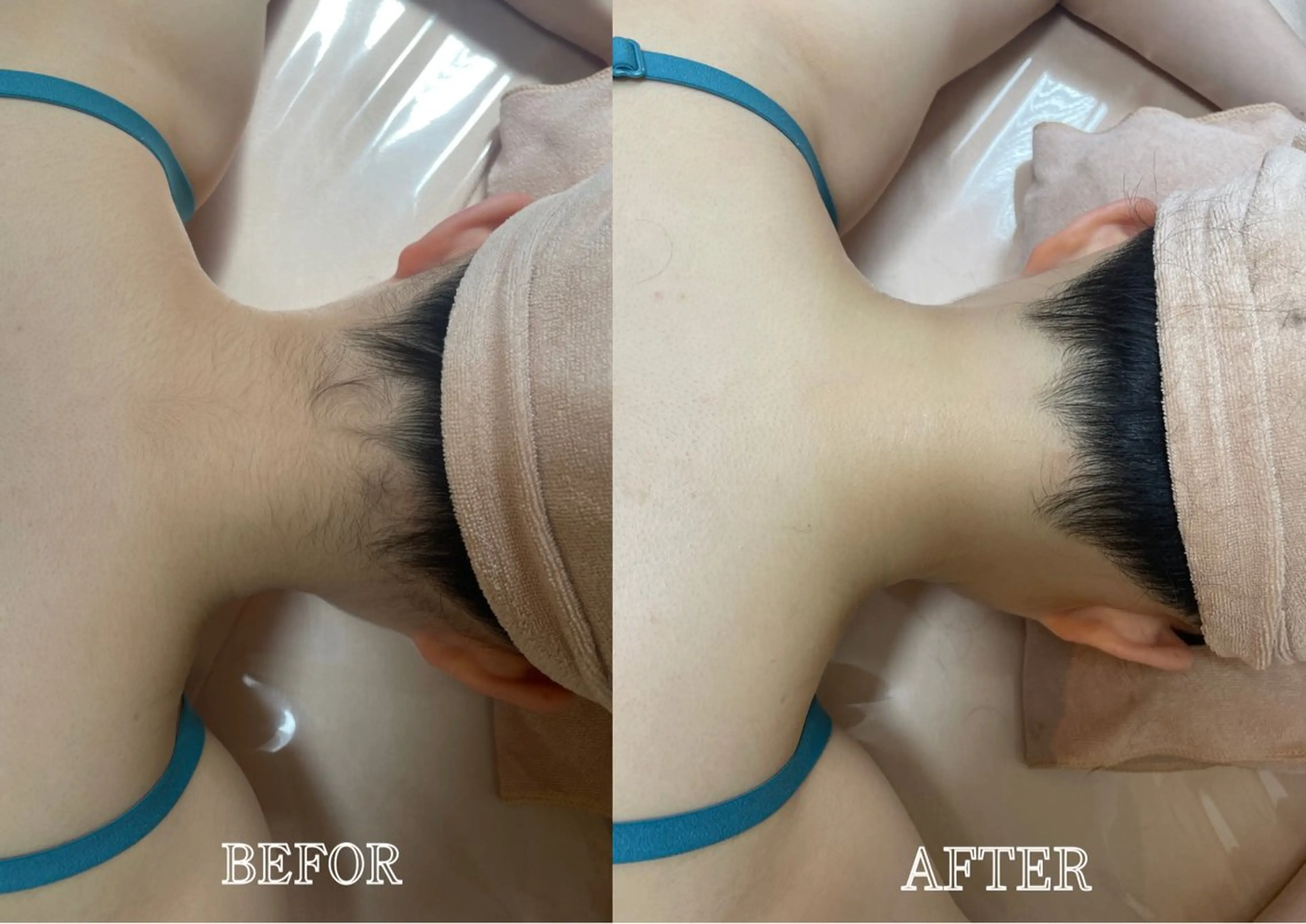 🌟平日限定🌟【襟足】まとめ髪も綺麗に仕上げれる💕ライブやイベント前に✨の写真