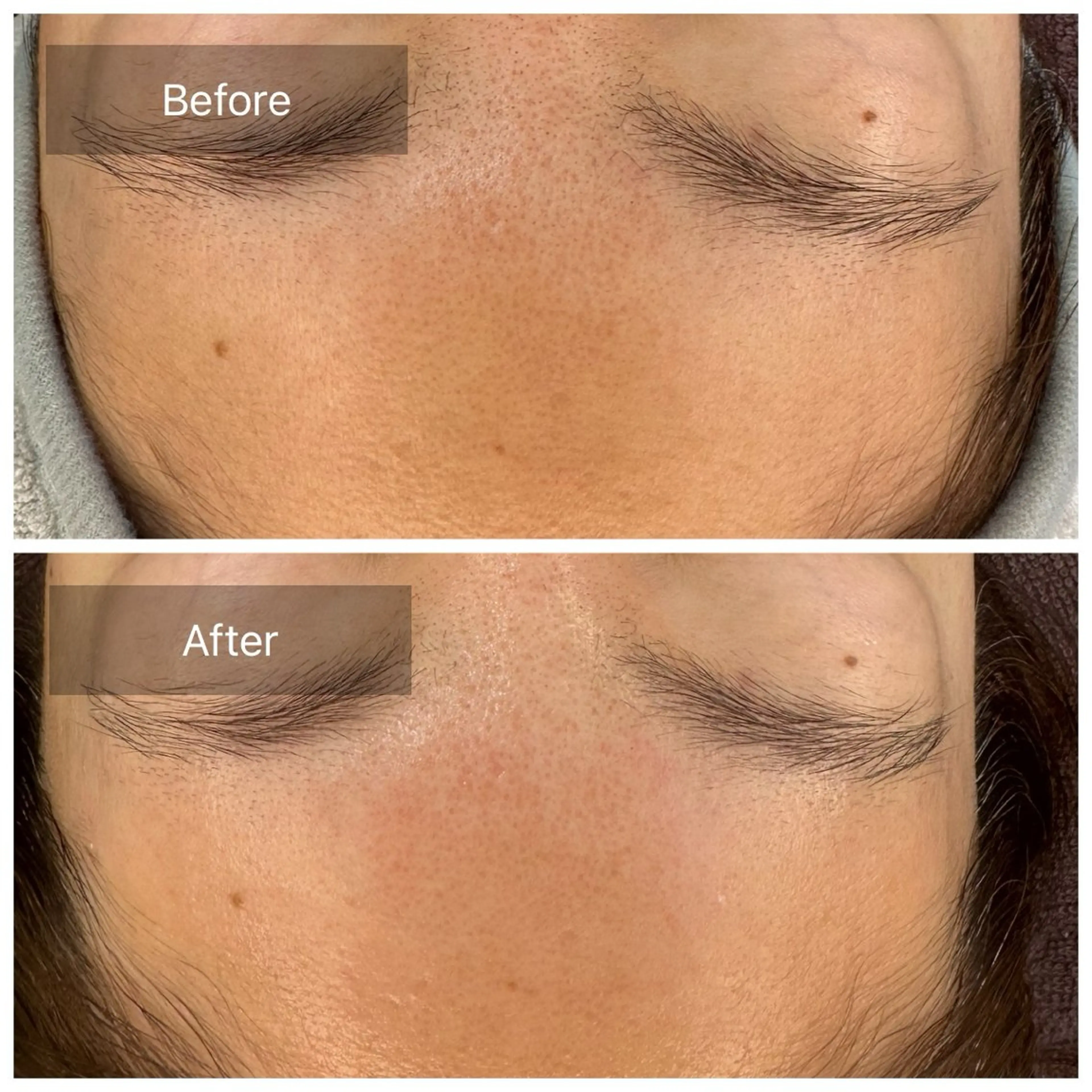 脱毛 トータルしみケア専門 NICA(ニカ)のエステ・リラクイメージ