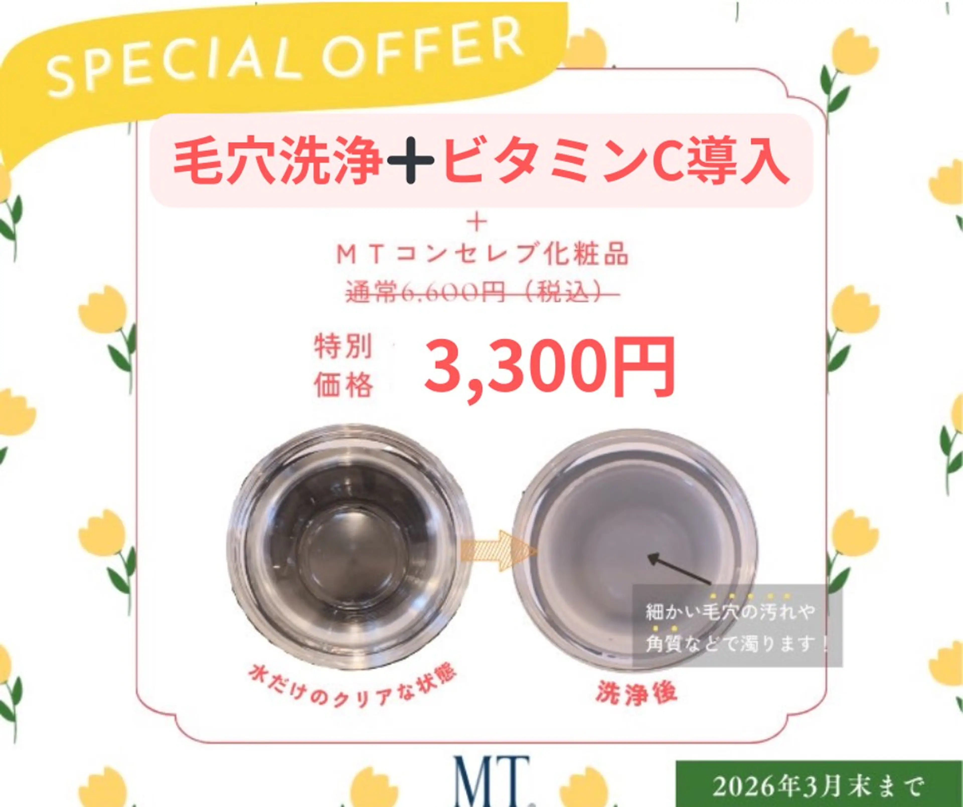 【毛穴トラブル・ニキビ・皮脂ベタつき・シミ・しわ】超音波イオン洗浄➕ビタミンC導入の写真