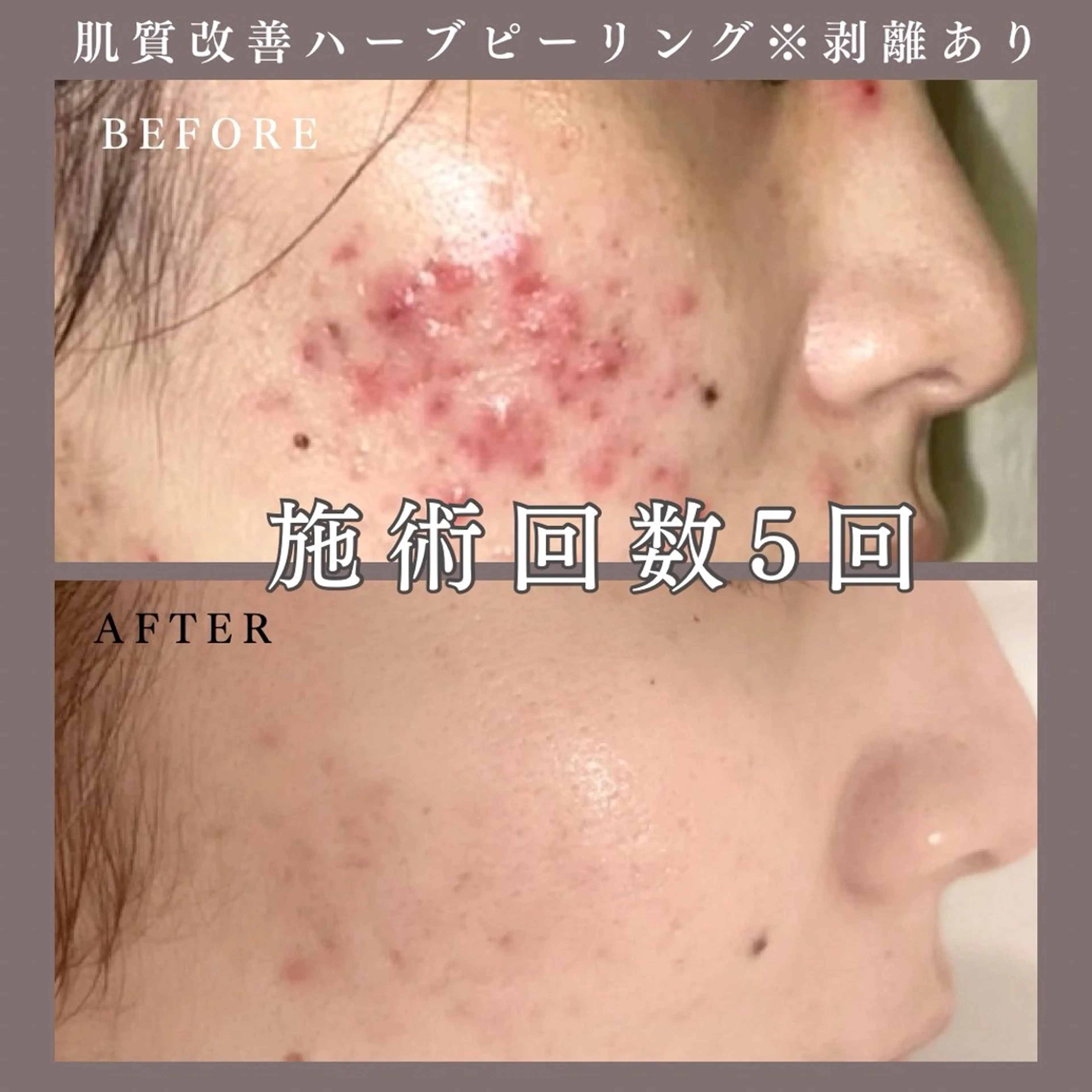 肌質改善専門サロン Bellmi/心斎橋のエステ・リラクイメージ