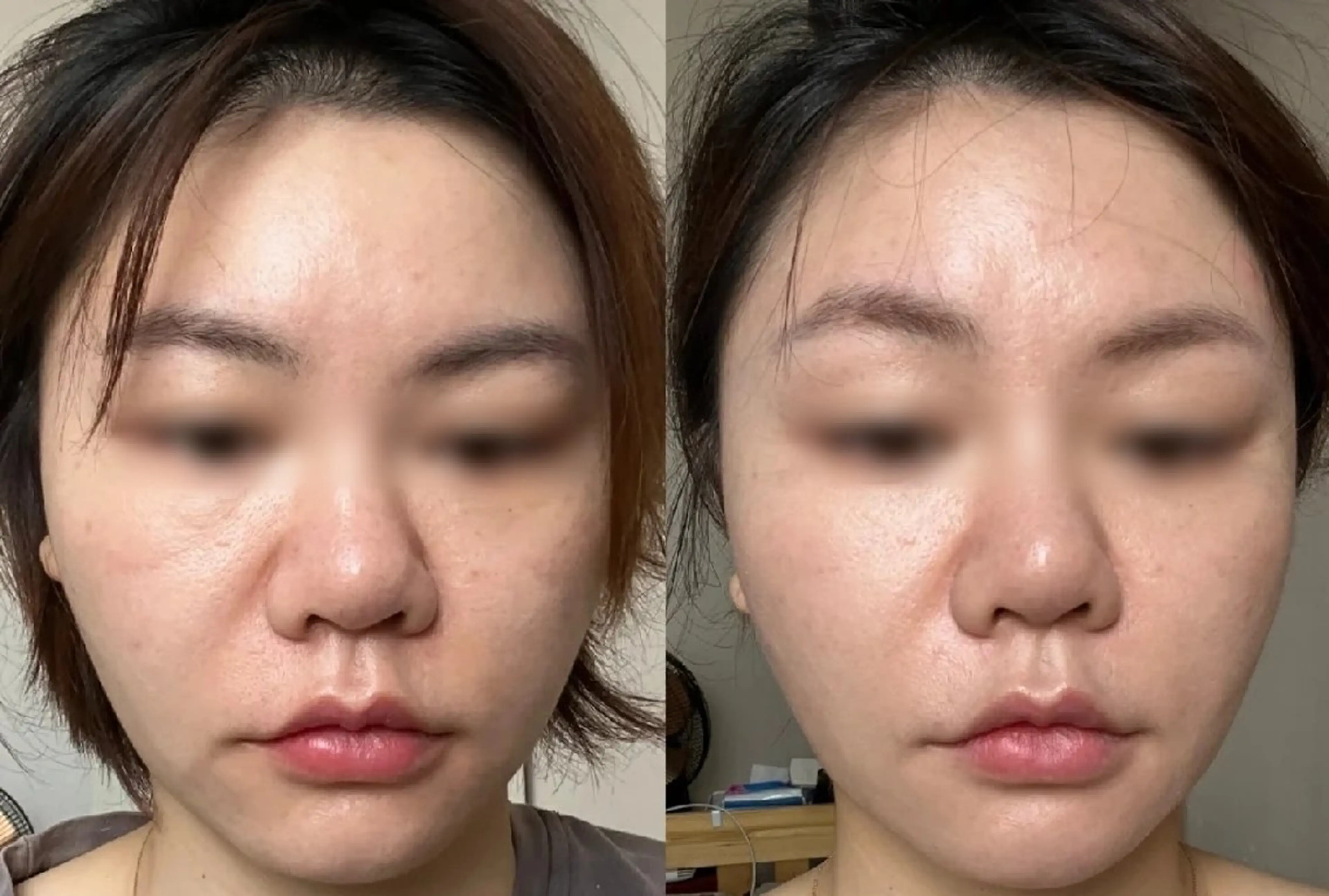 aliaハイフ&水光ジェットサロン所属・aliaハーブ水光店 エステティシャン募集のエステ・リラクイメージ