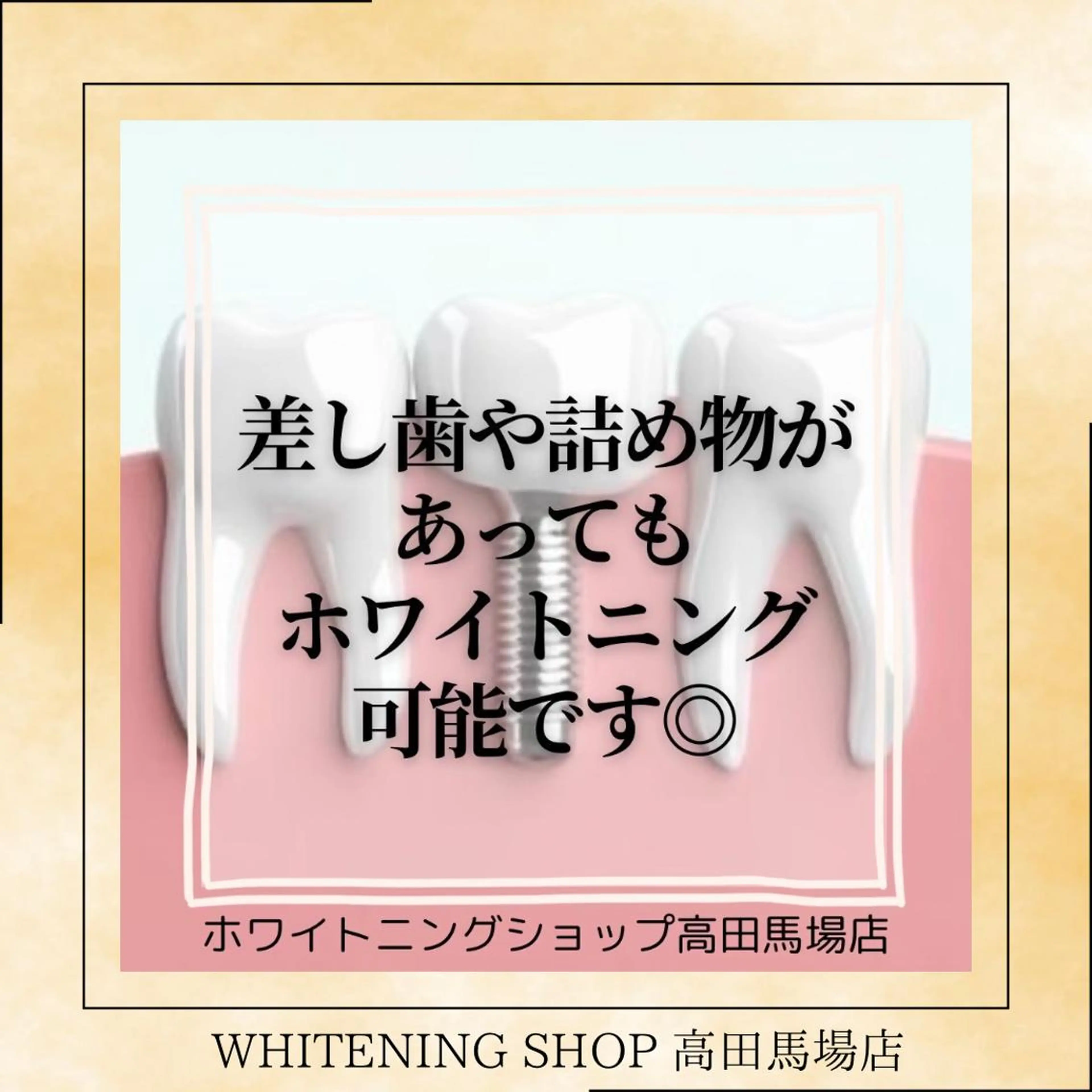 メンズ その他 ホワイトニング ショップ高田馬場店のその他イメージ