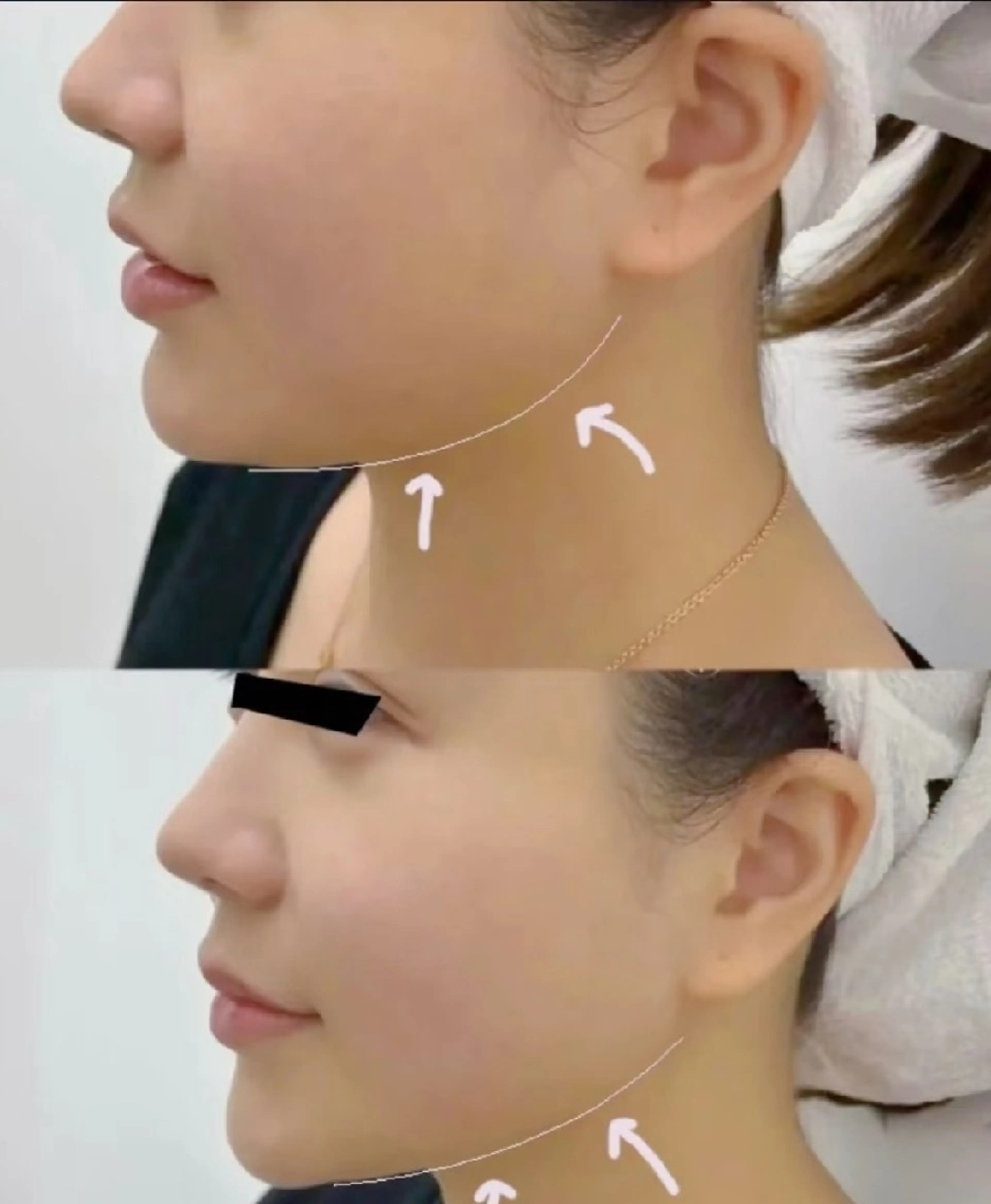 エステ aliaハイフ&水光ジェットサロン所属・aliaハーブ水光店 エステティシャン募集のエステ・リラクイメージ