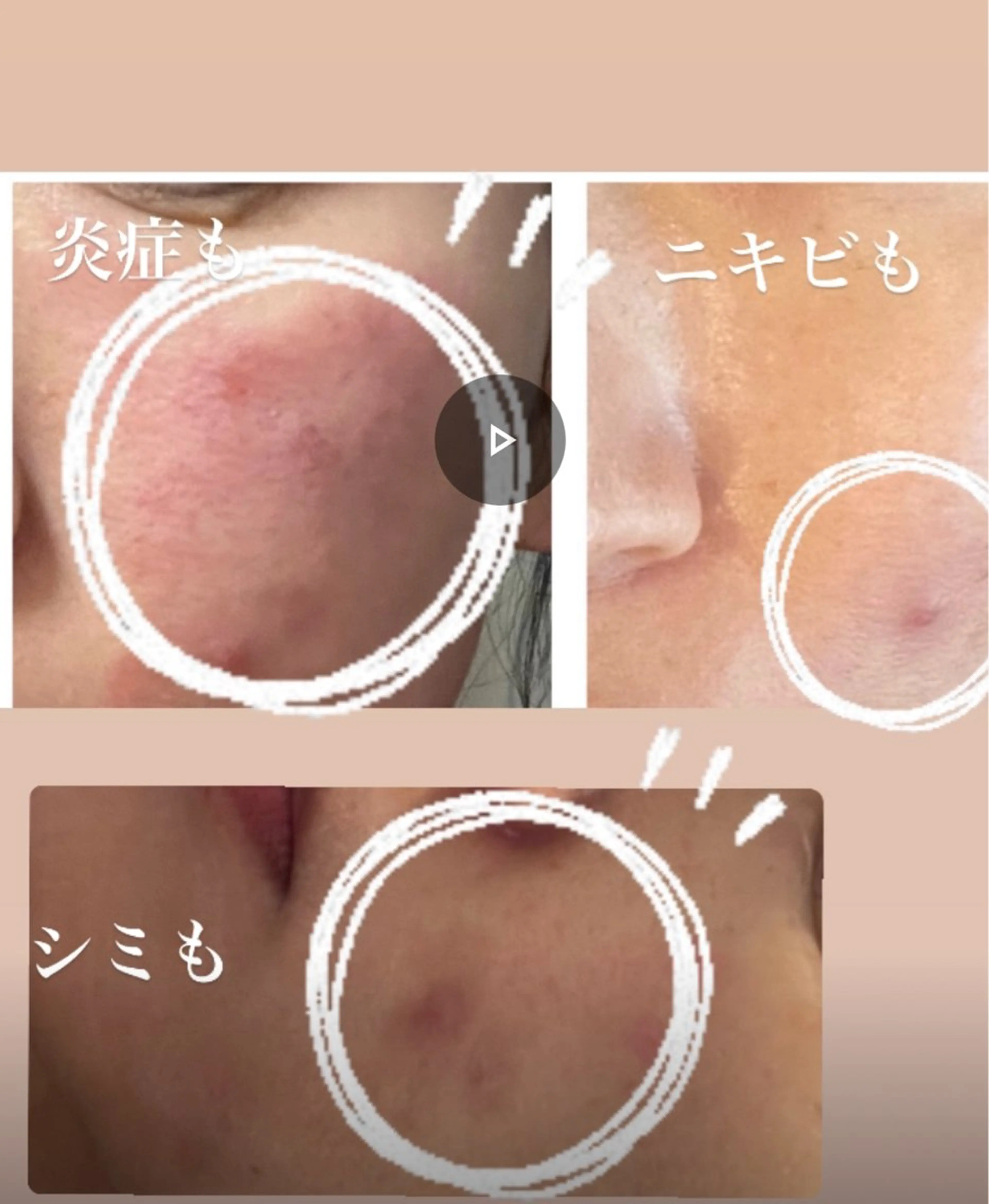 🅖🅤🅩🅔🅛 salonのエステ・リラクイメージ