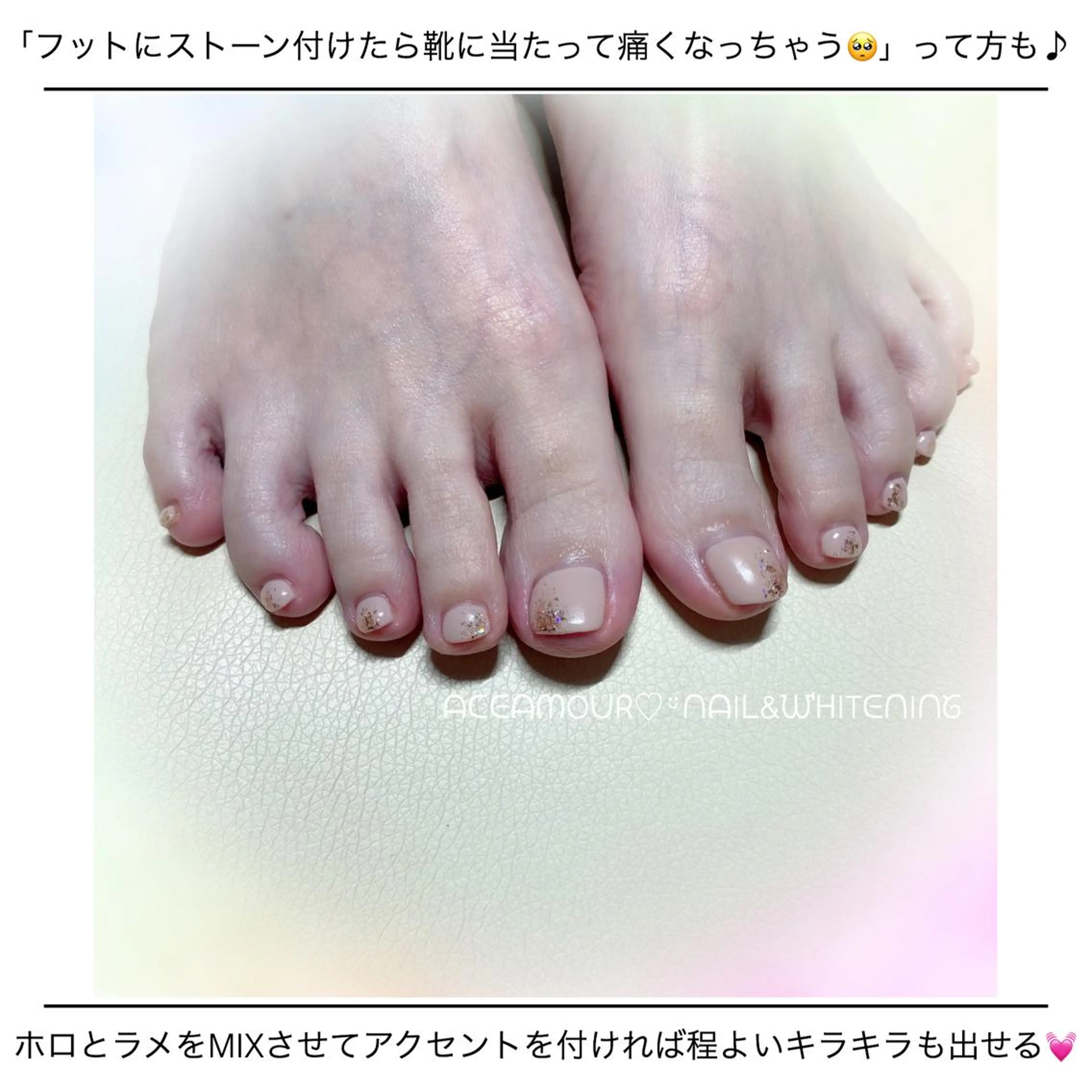 ネイル ネイル/耳つぼ /新ホワイトニングのネイルデザイン