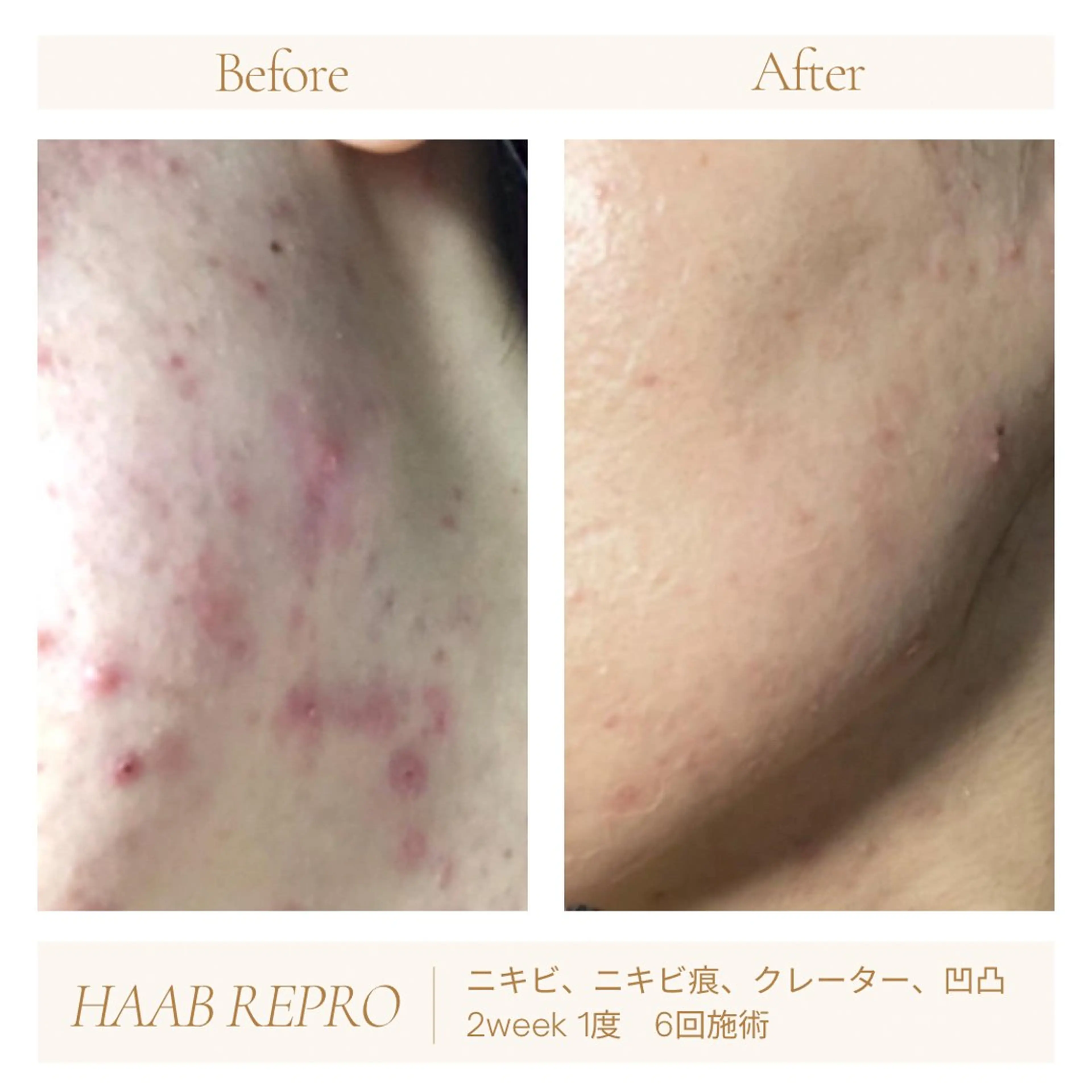 1ヶ月後も半分残る 高持続LEDエクステのマツエク・マツパデザイン