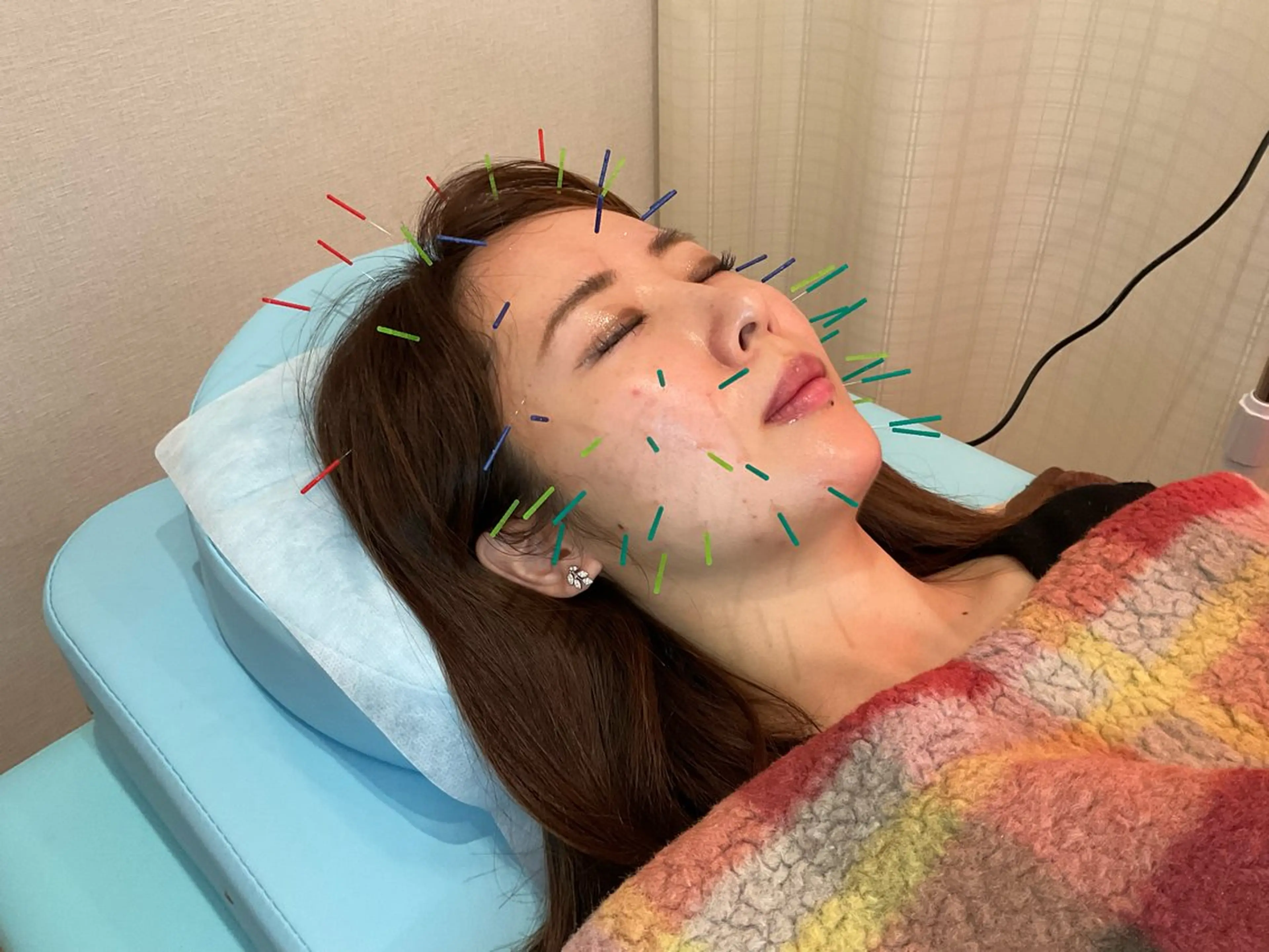 エステ リラク けい整骨院・鍼灸院所属・けい整骨院 鍼灸院のその他イメージ