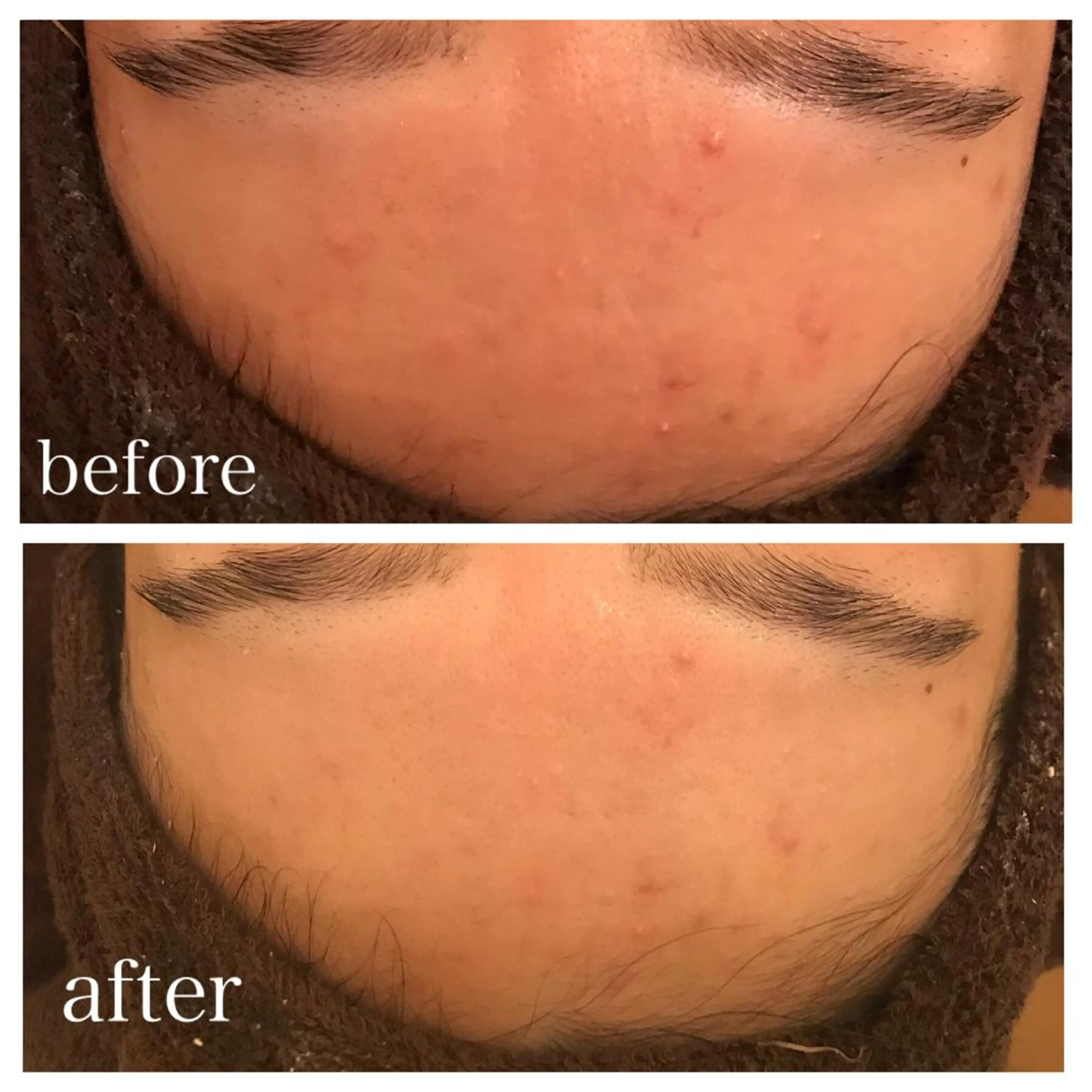 ミディアム エステ リラク ニキビ跡専門サロン Ａｉｎａのエステ・リラクイメージ