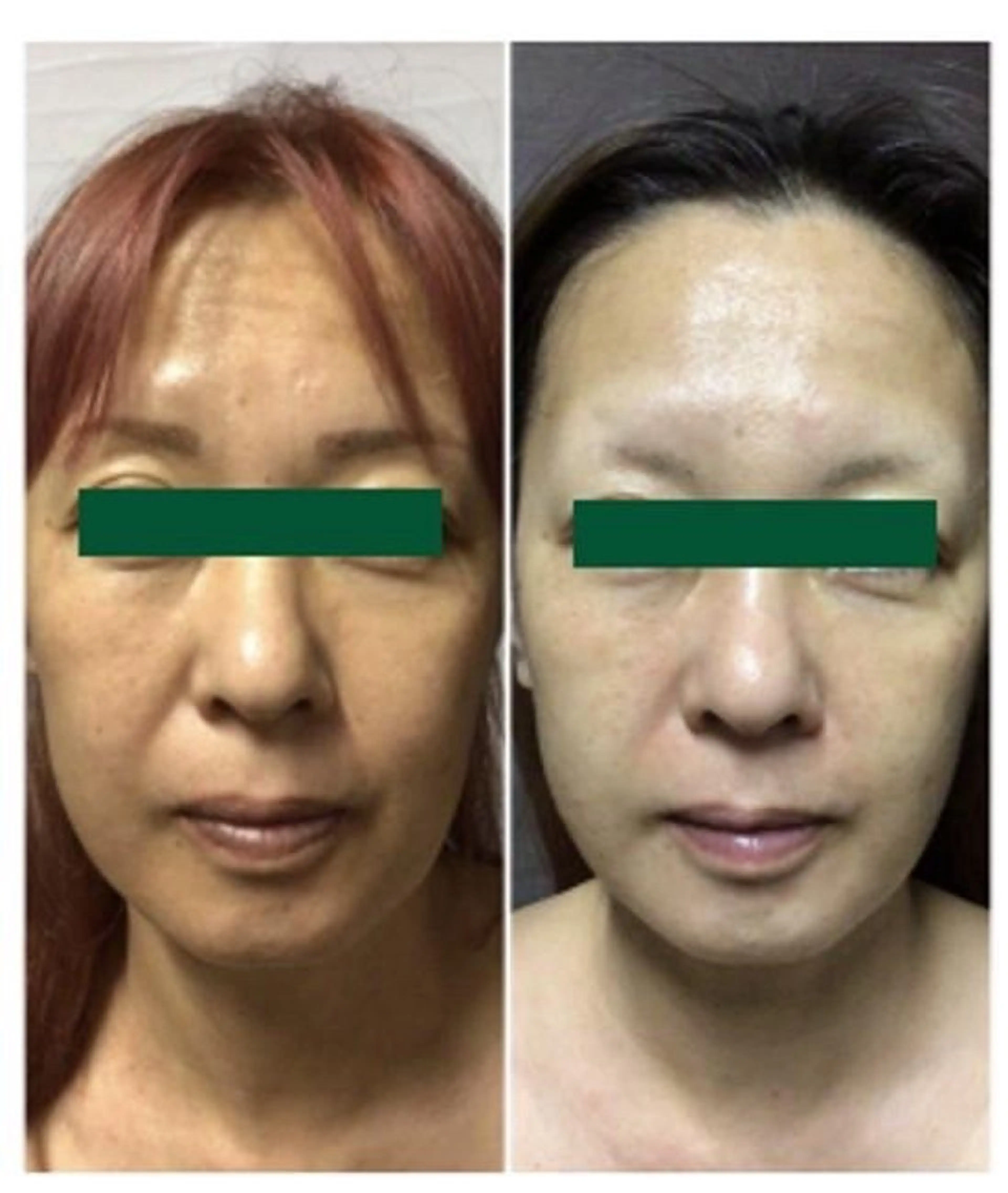 萩原 一樹のエステ・リラクイメージ