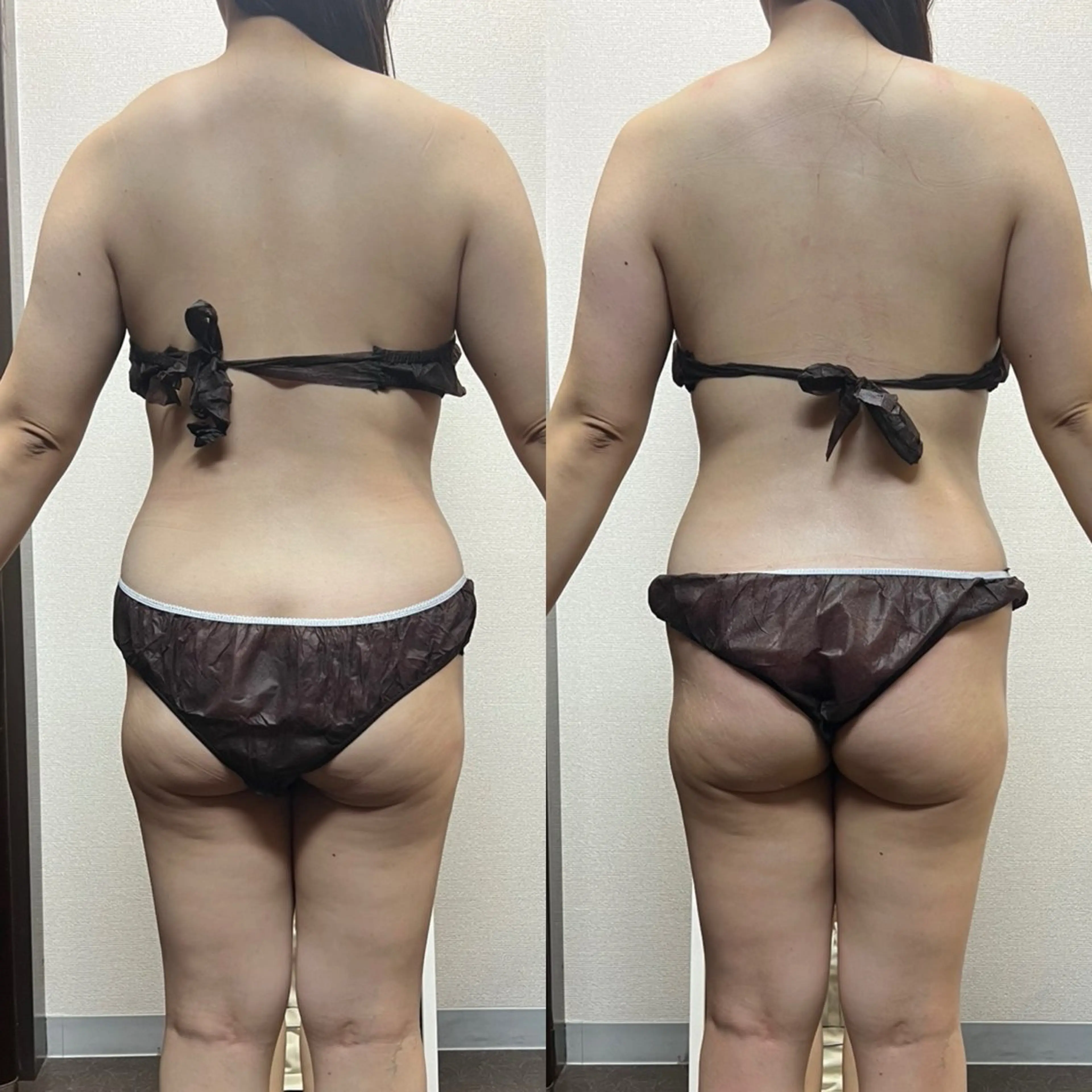 エステ ハイパーナイフ専門店　Salon de COCO所属・Salon de COCOのエステ・リラクイメージ