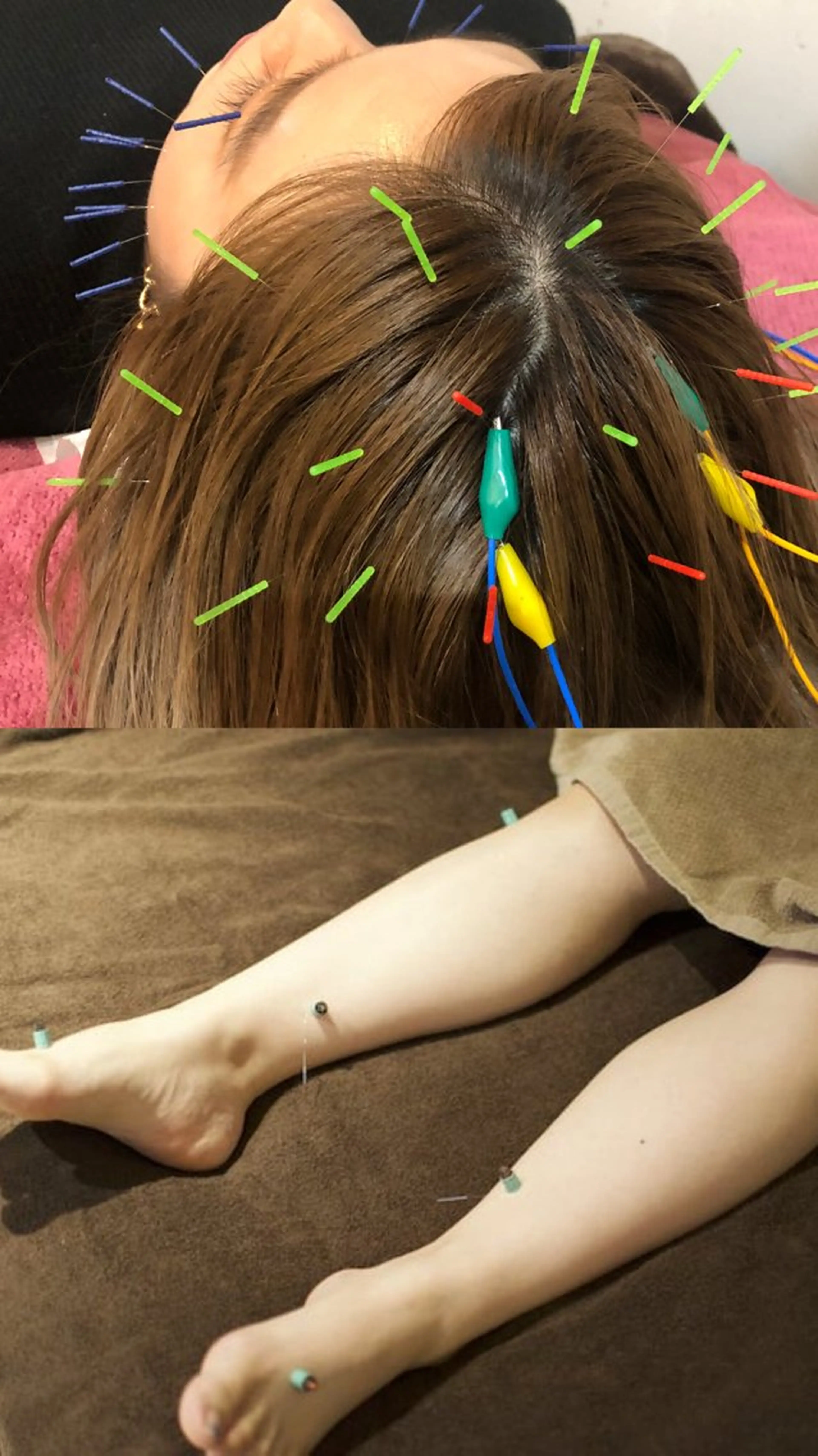 限定価格👍美顔＆美脚に💛むくみ解消コースの写真